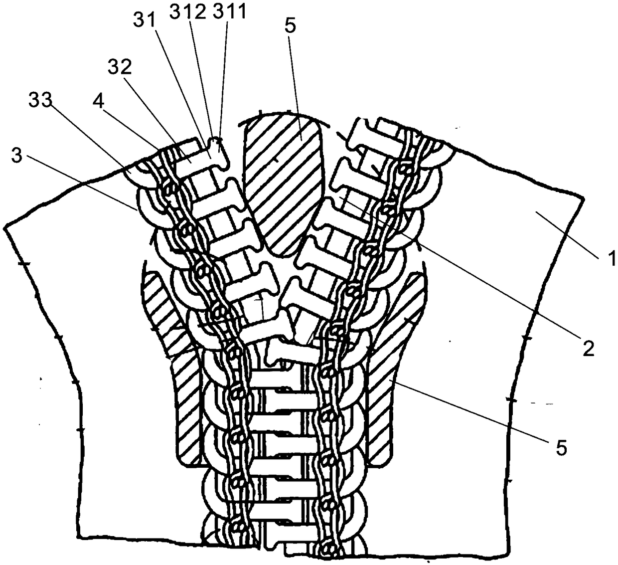 Anti-burst zipper