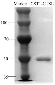 The application of the complex of cysteine ​​protease inhibitor sn and cathepsin L1 as a diagnostic marker for gastric cancer