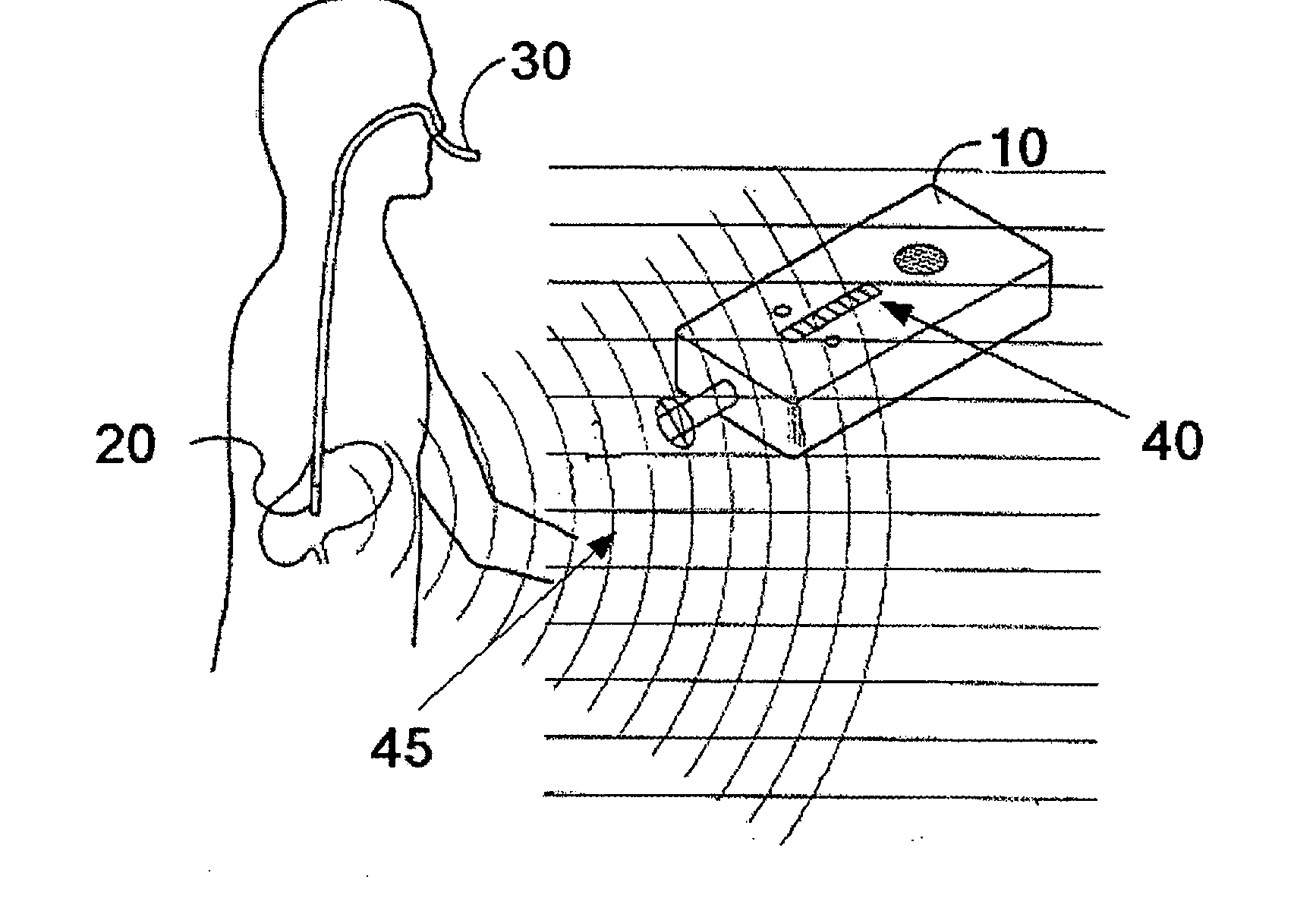 Medical tube and system for locating the same in a body using passive integrated transponders