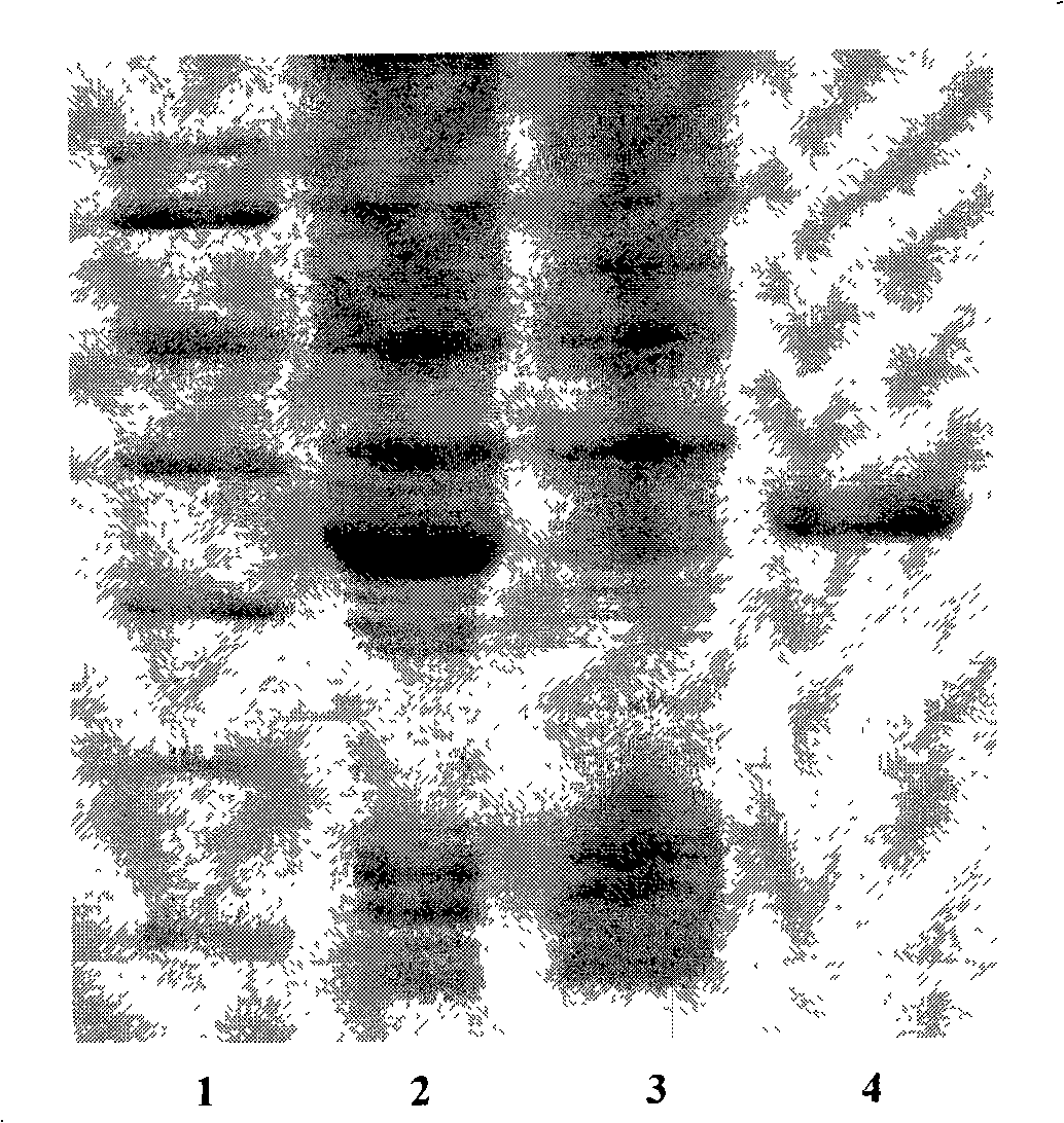 Method for recombination, amalgamation and expression of series antimicrobial peptide gene
