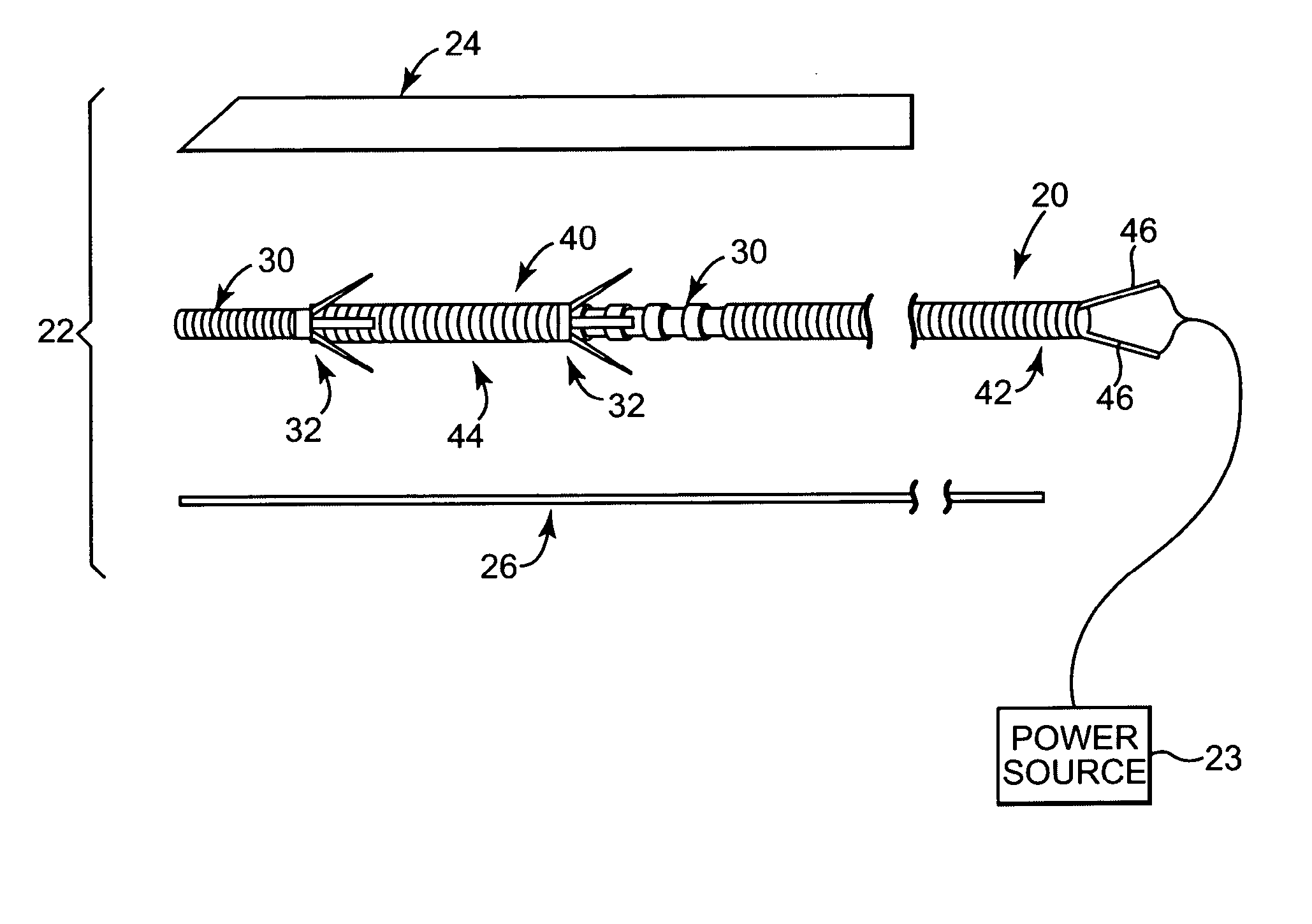 Implantable medical electrical stimulation lead, such as pne lead, and method of use