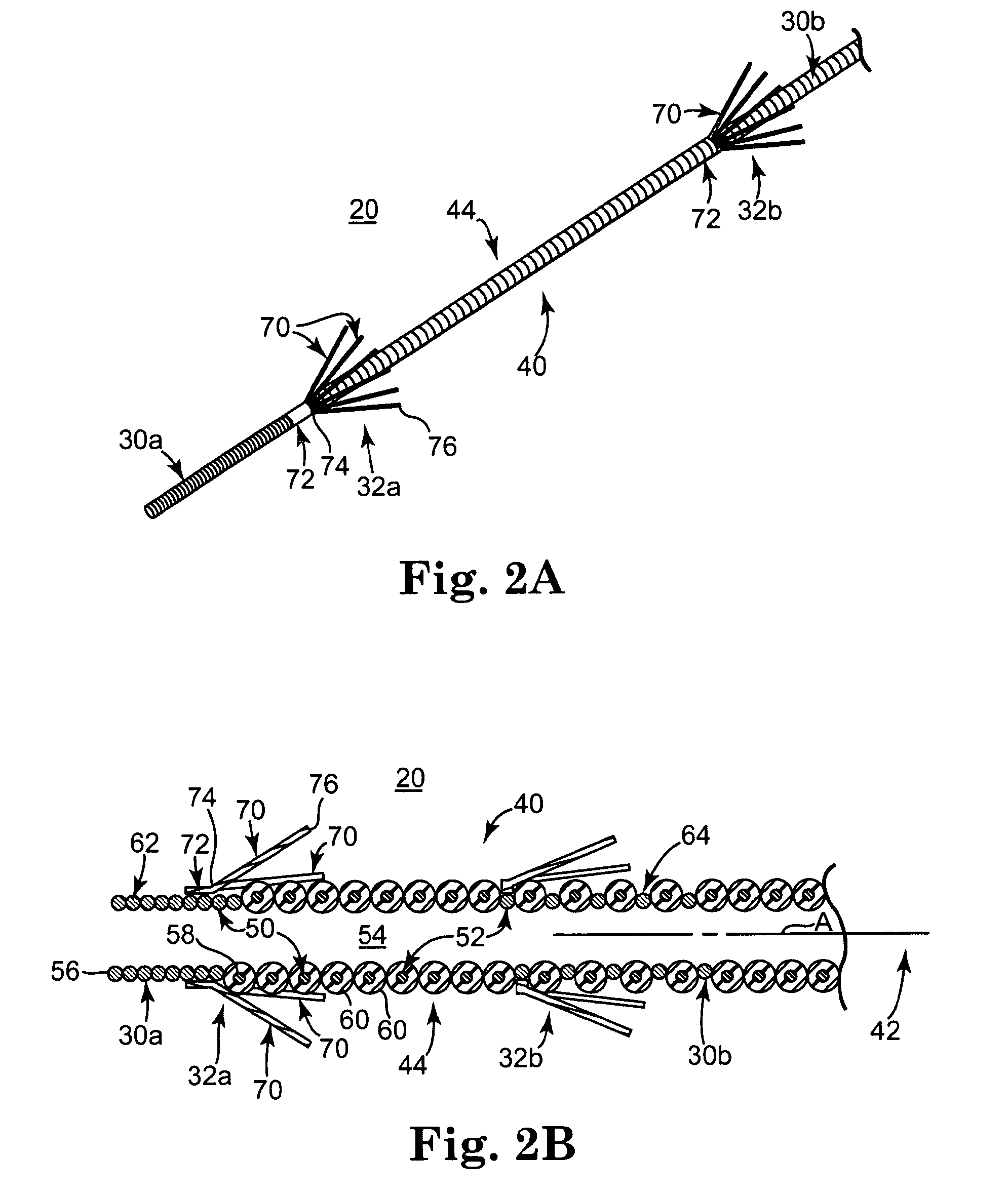 Implantable medical electrical stimulation lead, such as pne lead, and method of use
