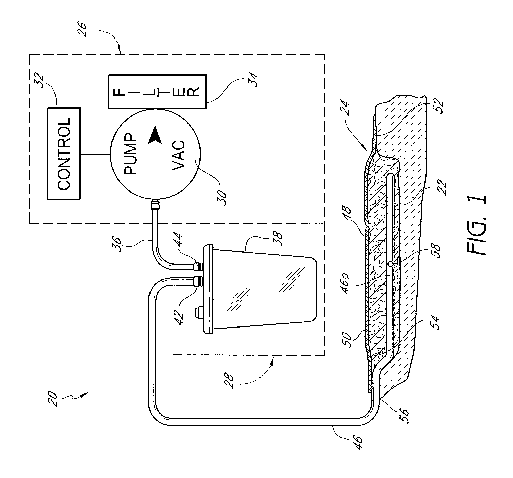 Auxiliary powered negative pressure wound therapy apparatuses and methods