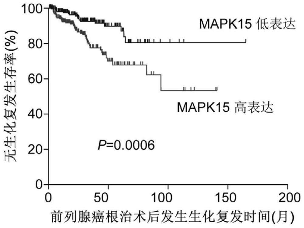 Application of MAPK15 protein in prediction of malignancy degree or prognosis degree of prostate cancer
