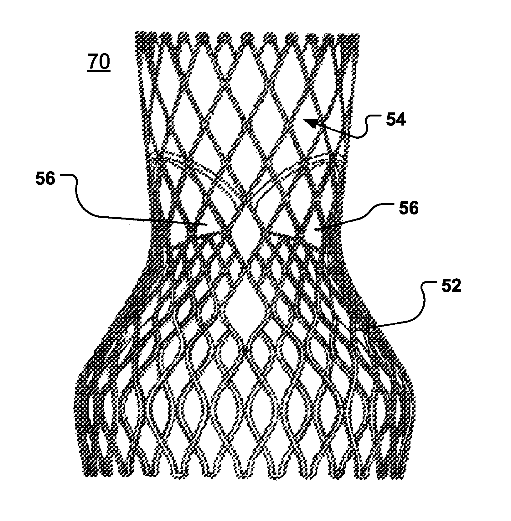 Arrangement, A Loop-Shaped Support, A Prosthetic Heart Valve And A Method Of Repairing Or Replacing A Native Heart Valve