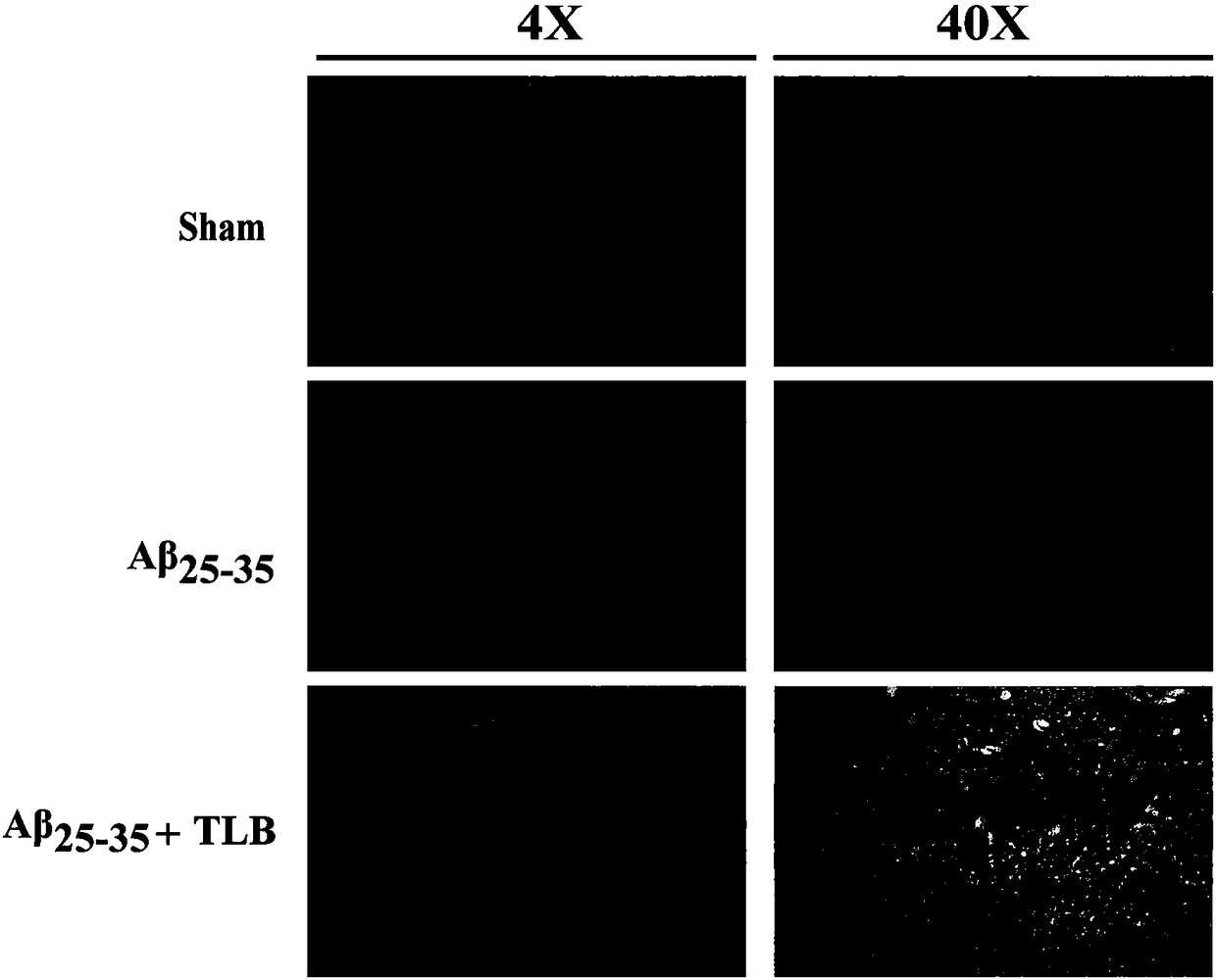 Application of trilobatin in preparing medicine for treating alzheimer disease