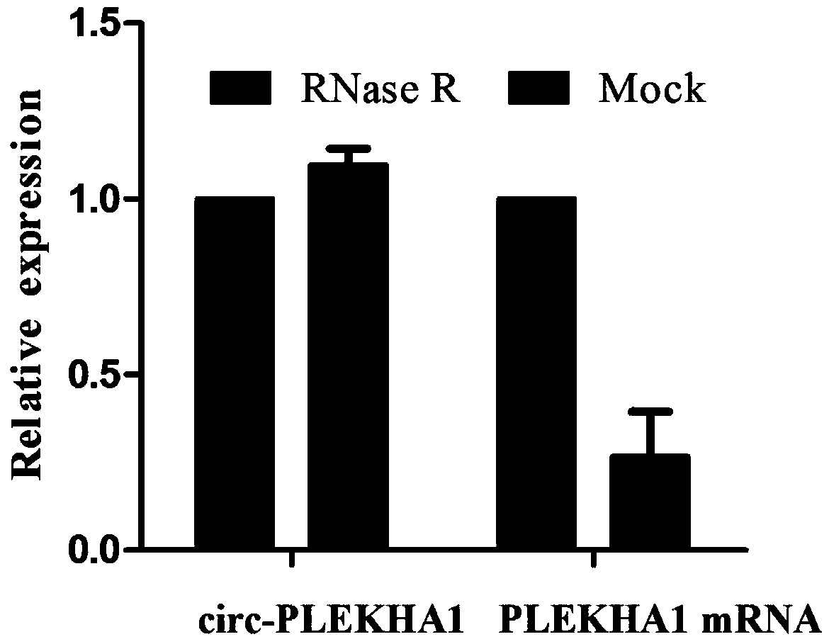 Application of circ-PLEKHA1 molecular marker in blood to diagnosis of ESCC (esophageal squamous carcinoma)