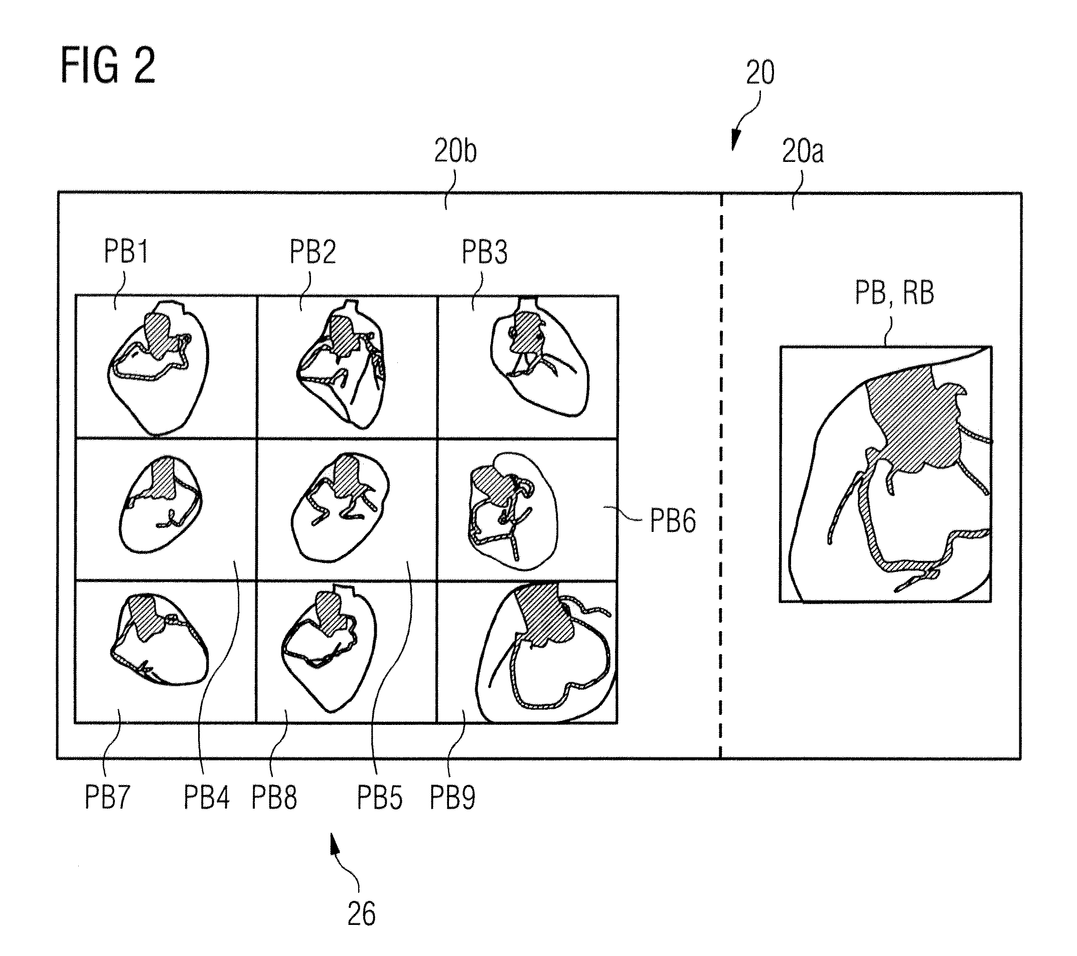 Medical technology system and operating a method therefor with reduced time required for acquisition of projection images