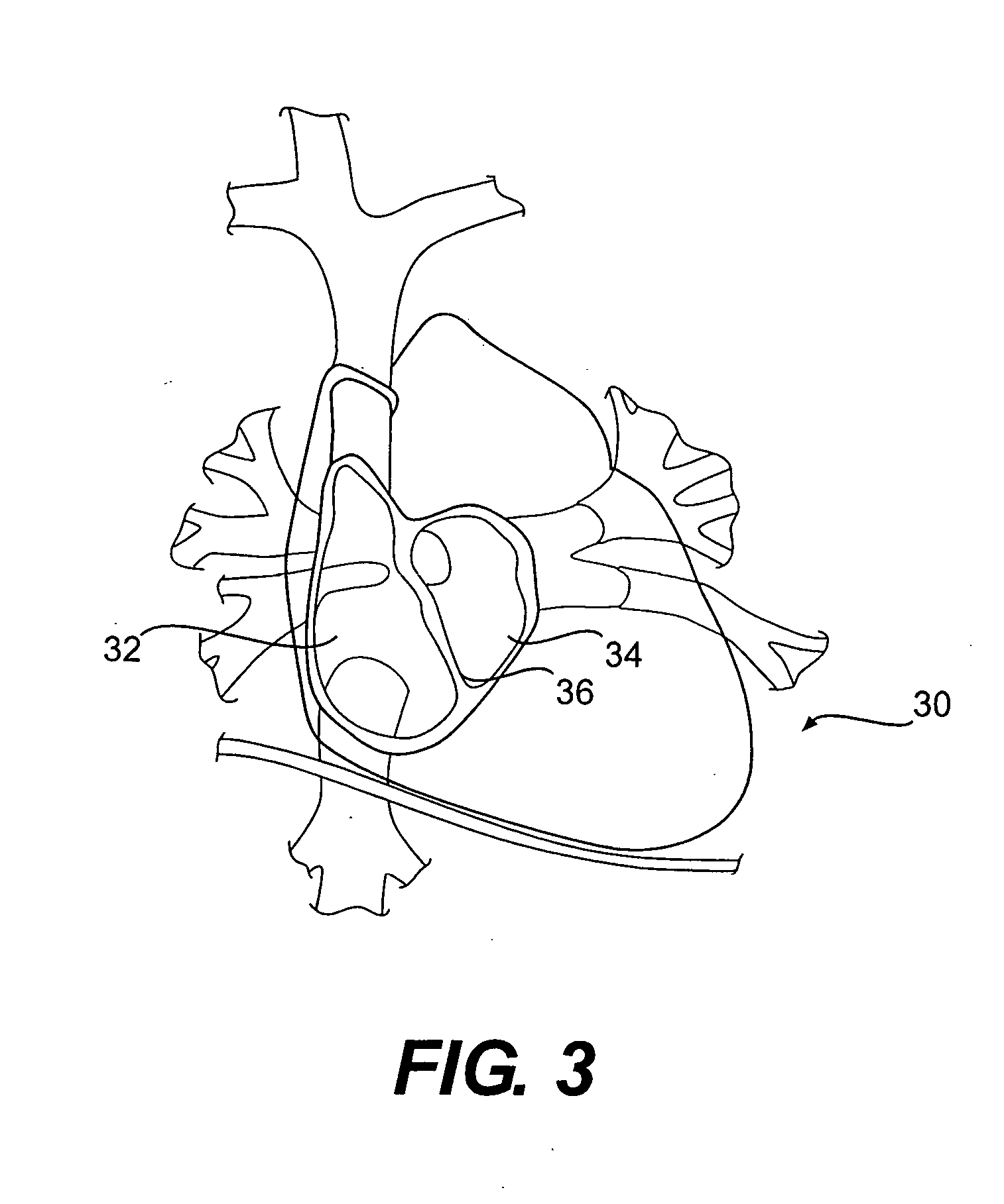Implantable device for telemetric measurement of blood pressure/temperature within the heart