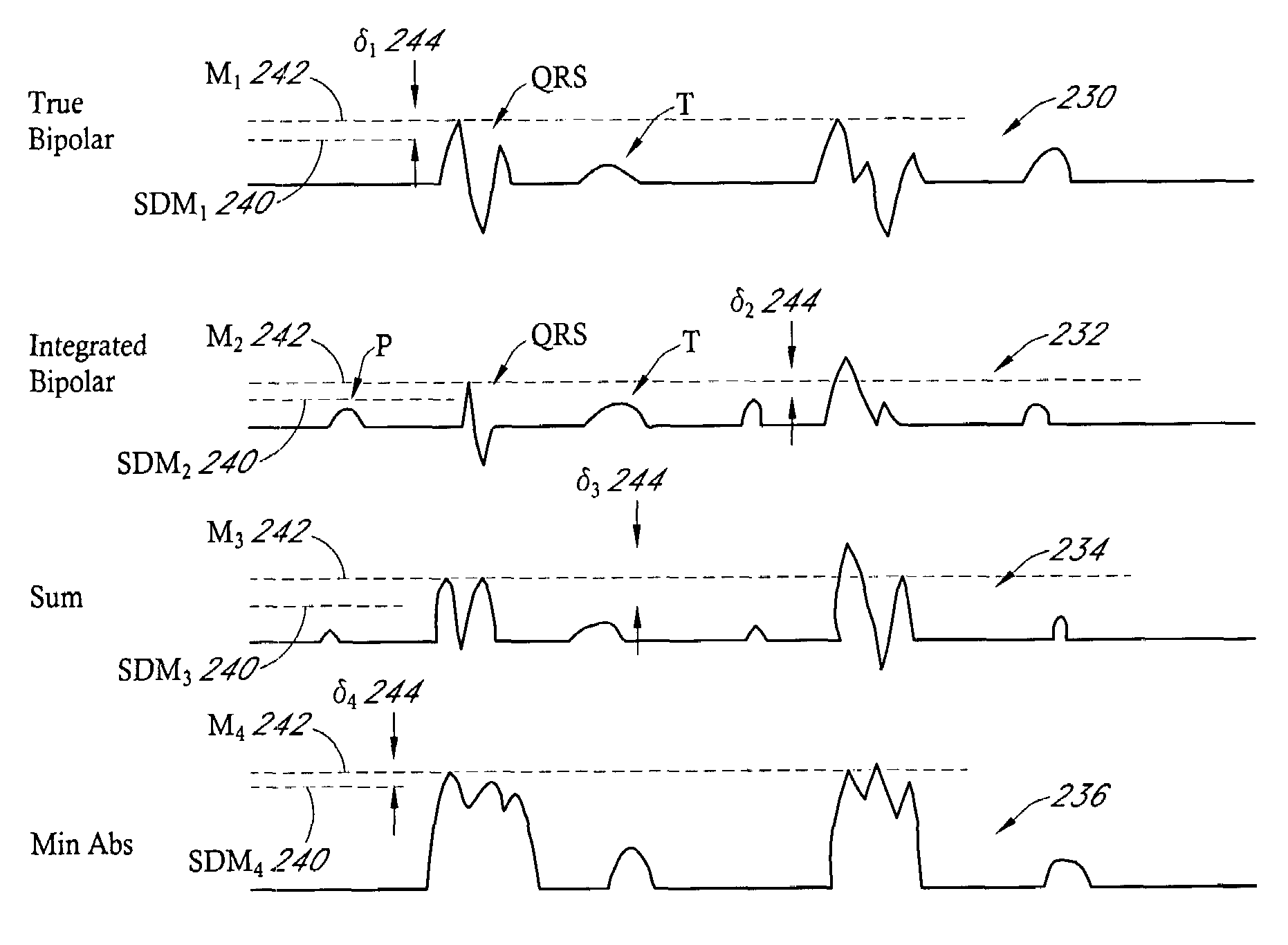Implantable medical device with automatic sensing adjustment