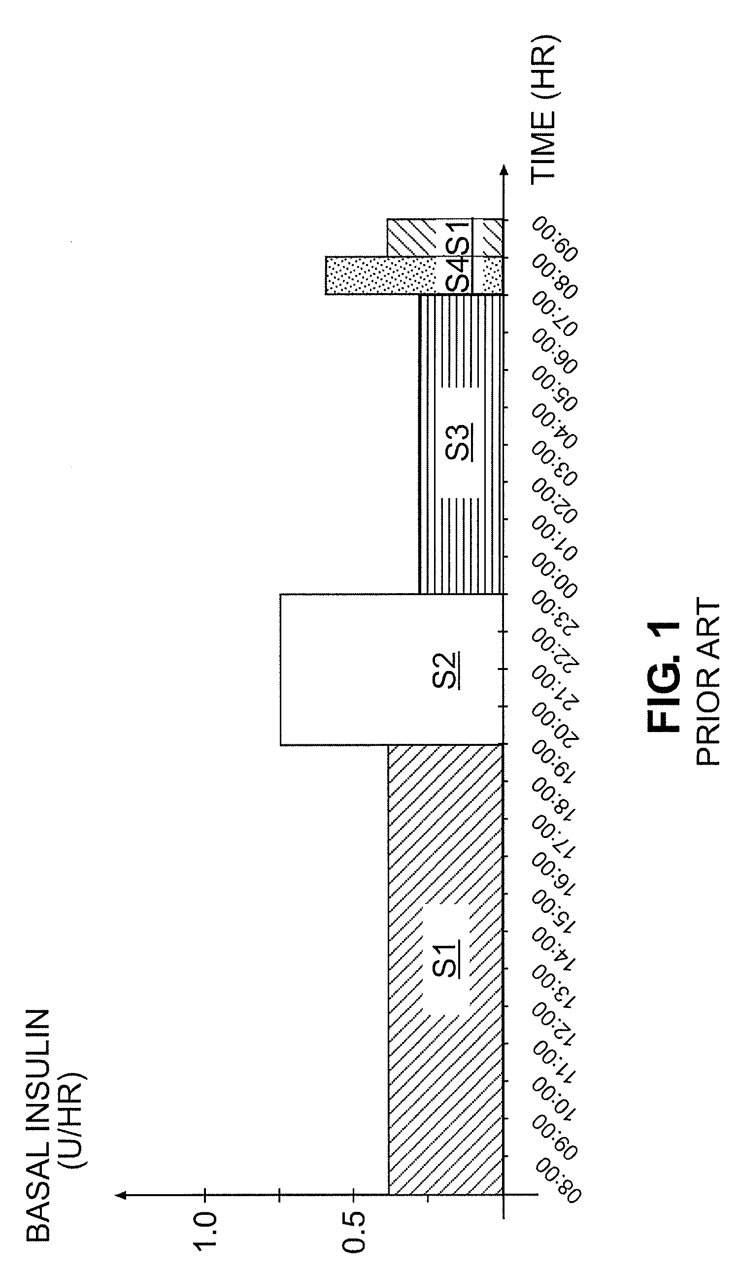 Tailored basal insulin delivery system and method