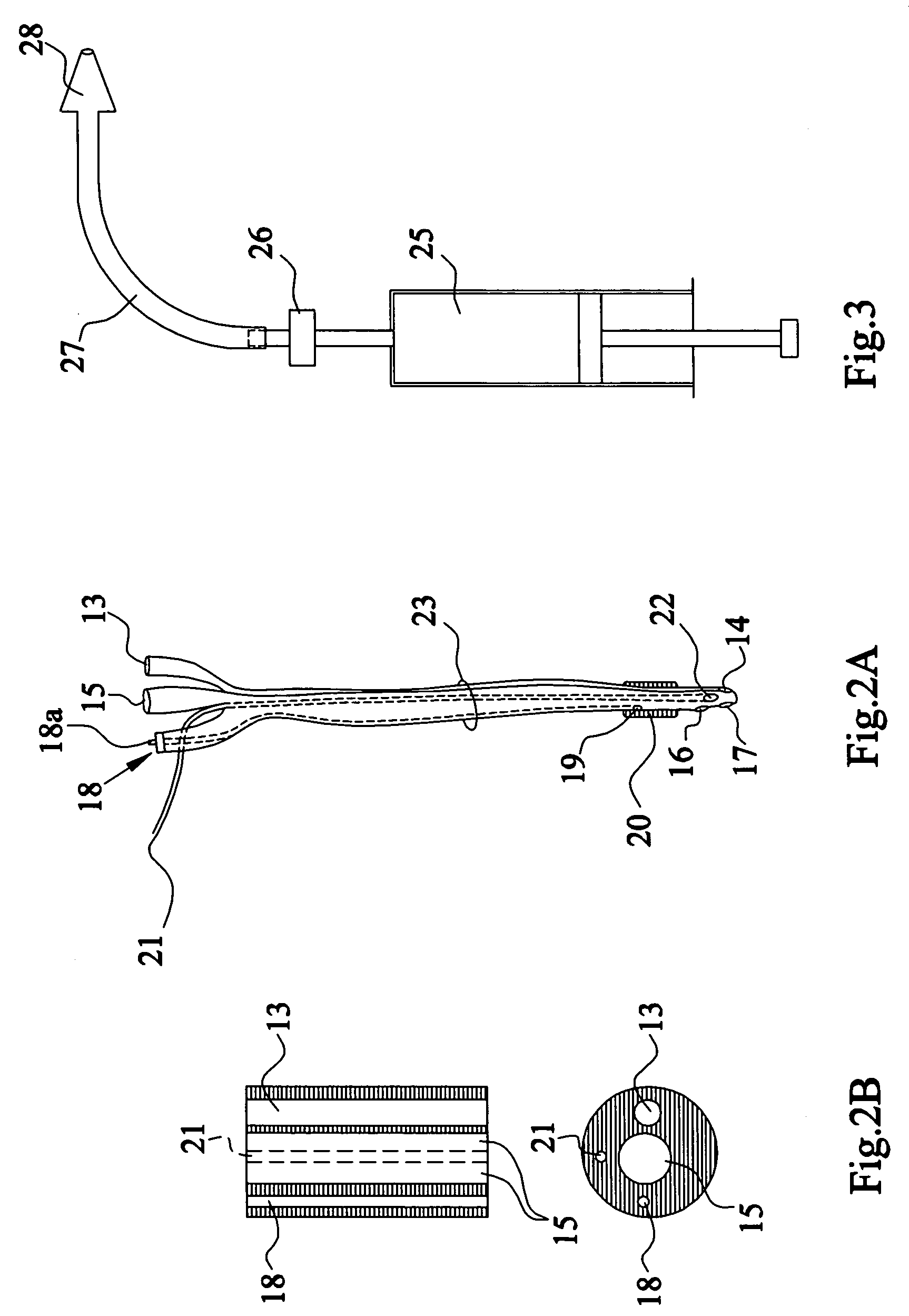 Apparatus and method for the controlled hydrodistention of the urinary bladder