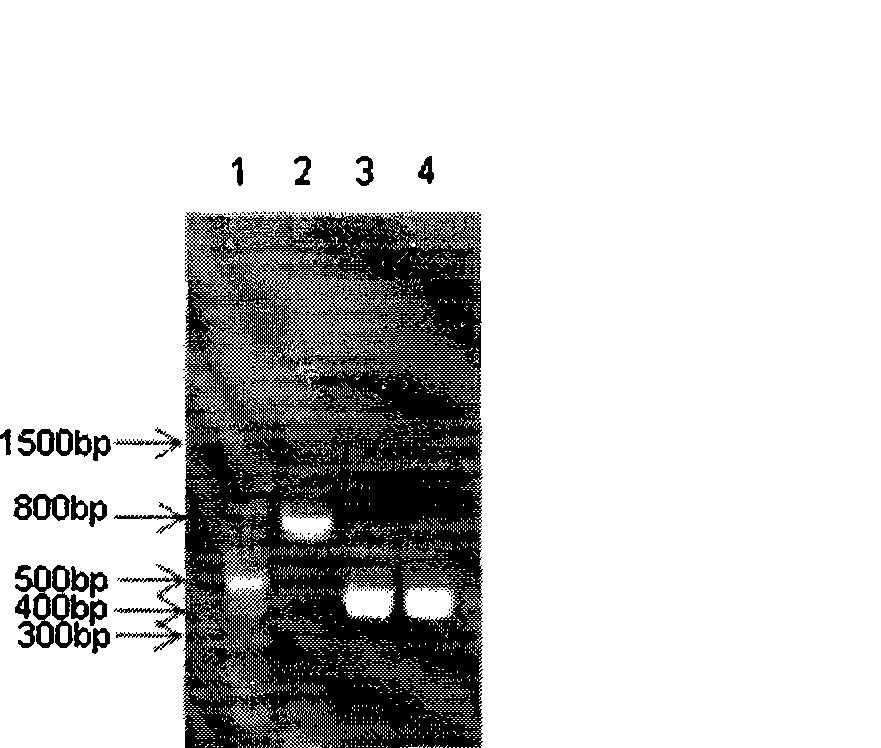 Heavy and light chain variable region gene of monoclonal antibody, encoding polypeptide thereof and use
