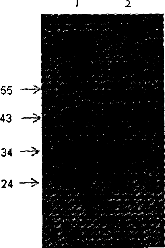 Heavy and light chain variable region gene of monoclonal antibody, encoding polypeptide thereof and use