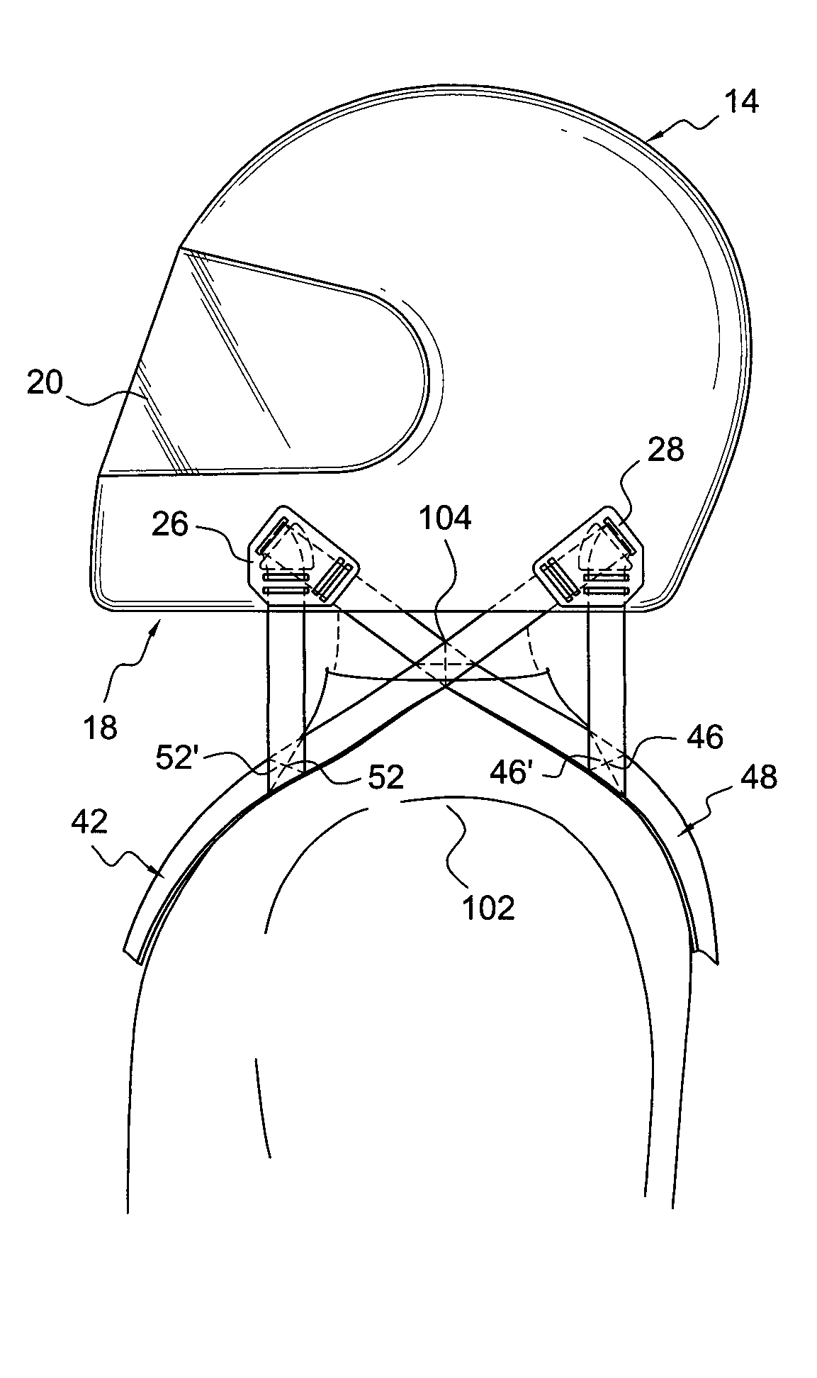 Head and Neck Restraint System