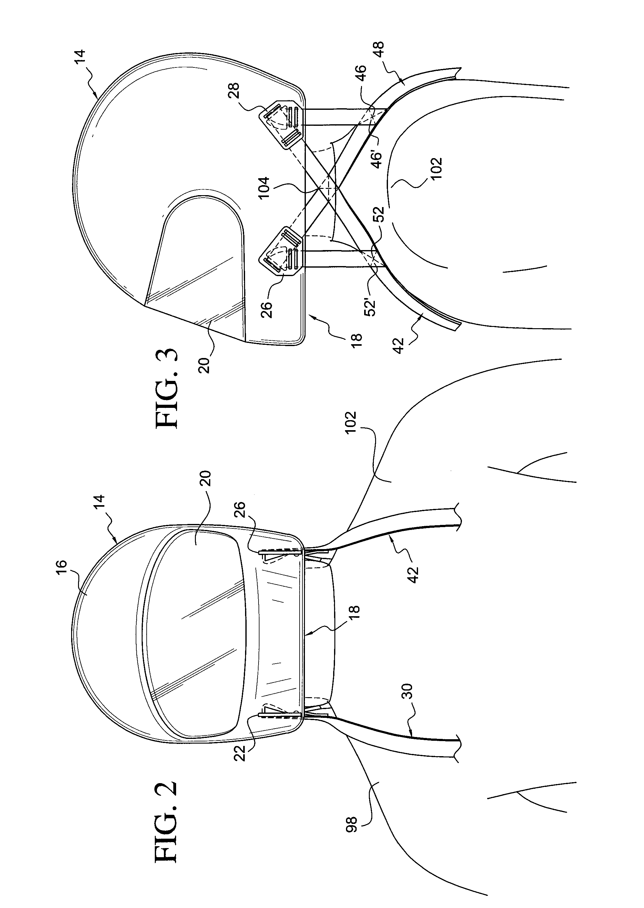 Head and Neck Restraint System