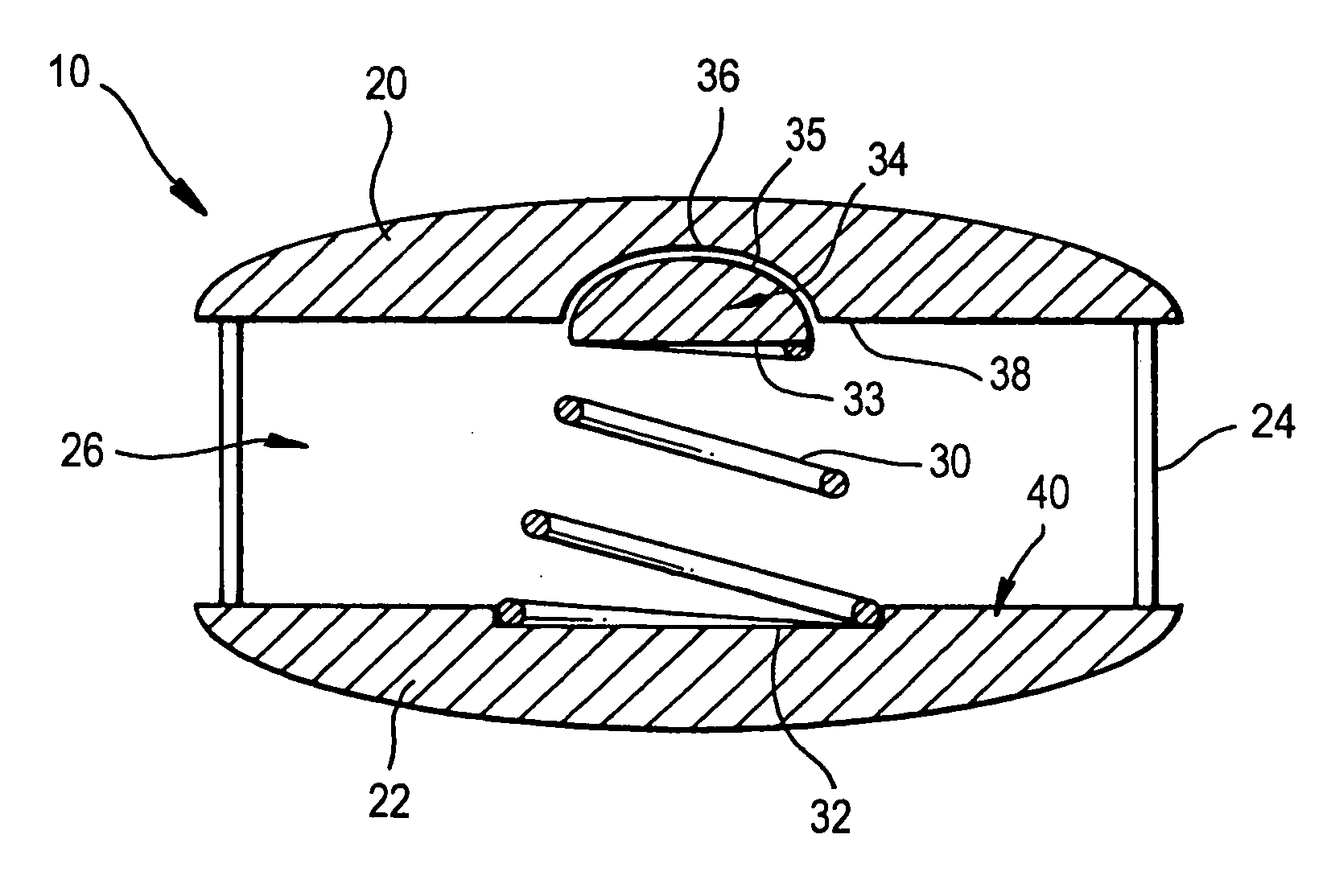 Controlled artificial intervertebral disc implant