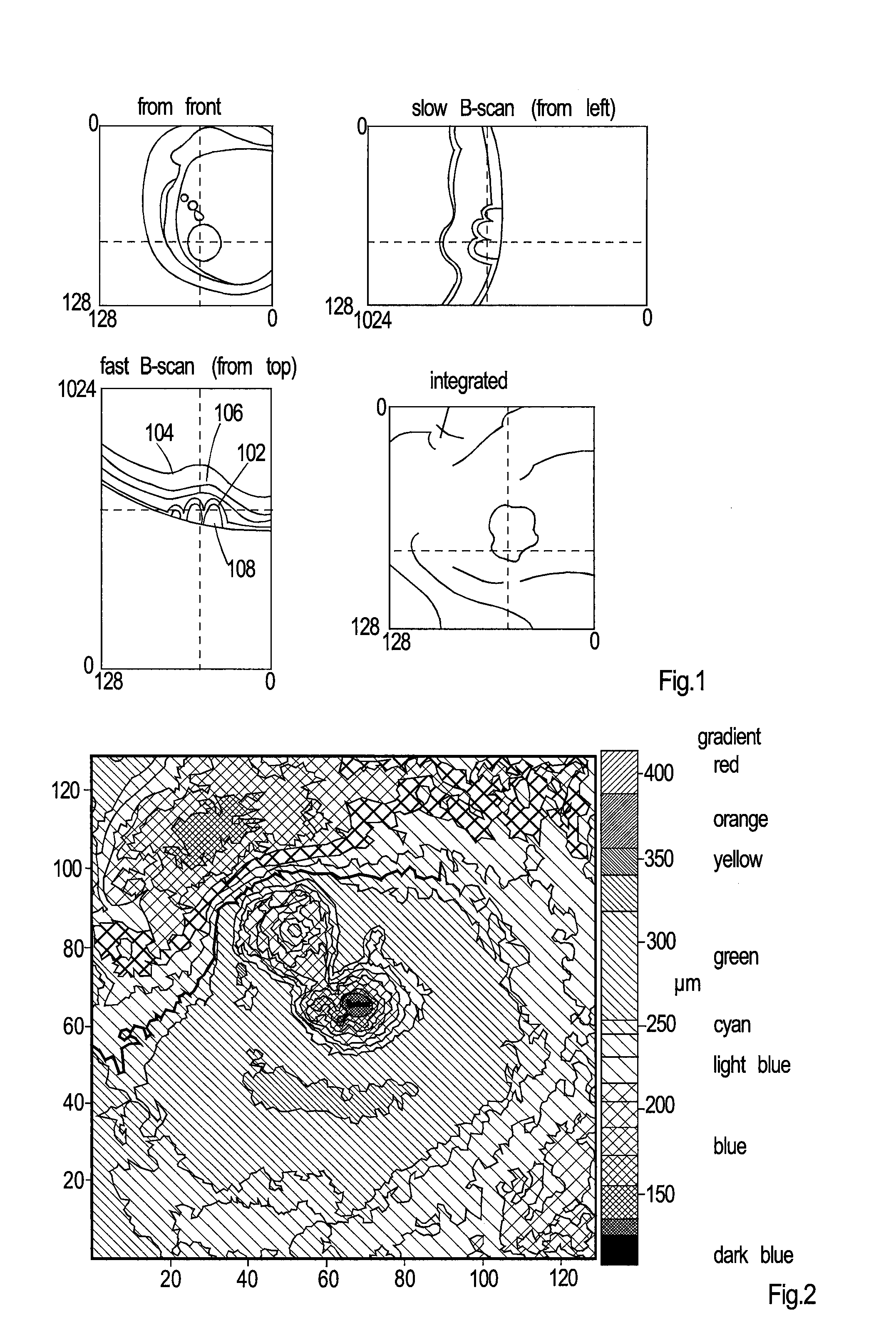 Method of bioimage data processing for revealing more meaningful anatomic features of diseased tissues