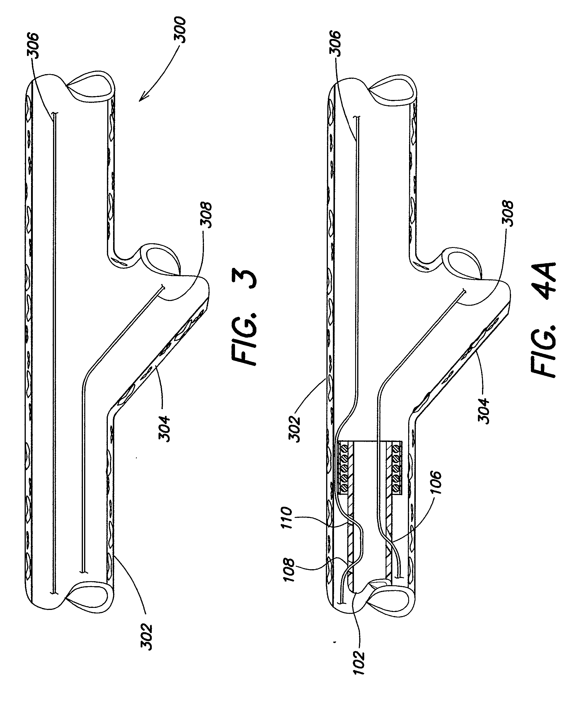 Delivery system and method of use for accurate positioning of a device in a bifurcation