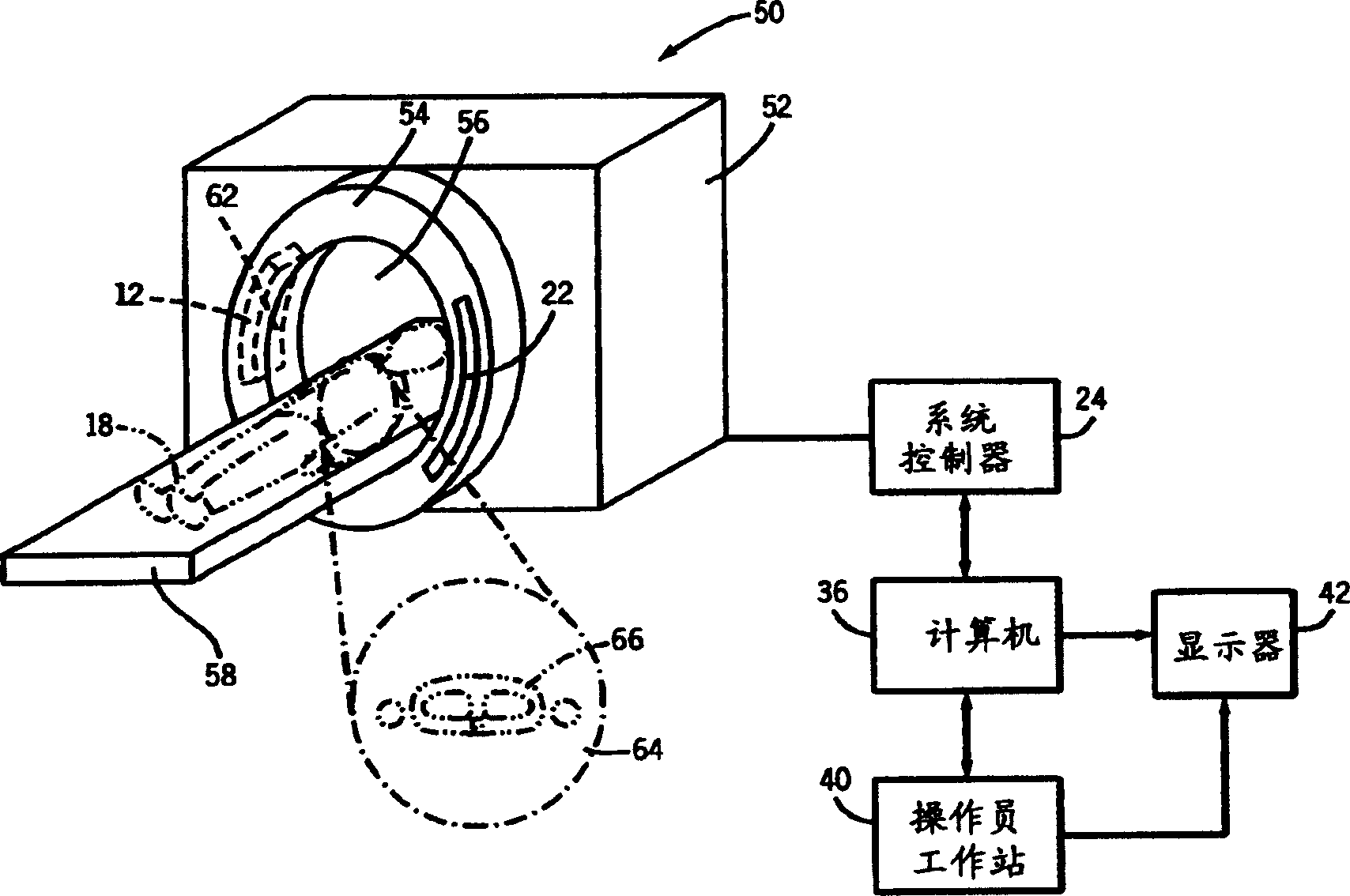 Method and apparatus for segmenting structure in CT angiography