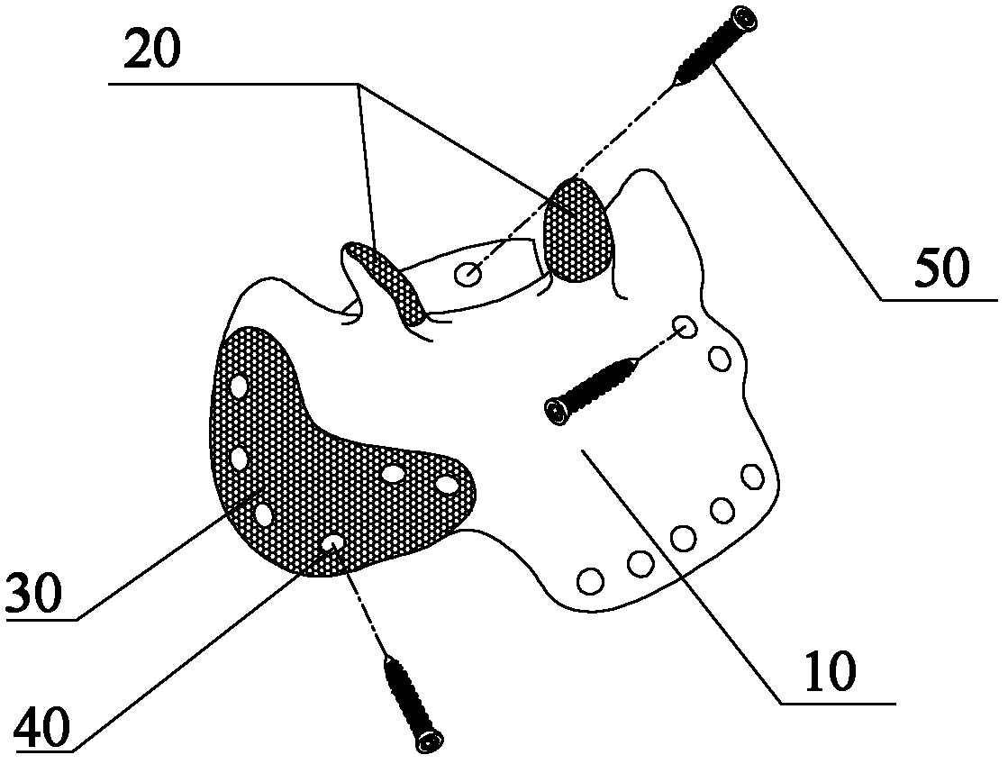 Artificial sacrum prosthesis