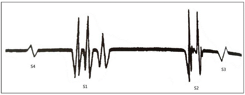 Method for cardiac sound waveform data processing and graph displaying and auscultation system