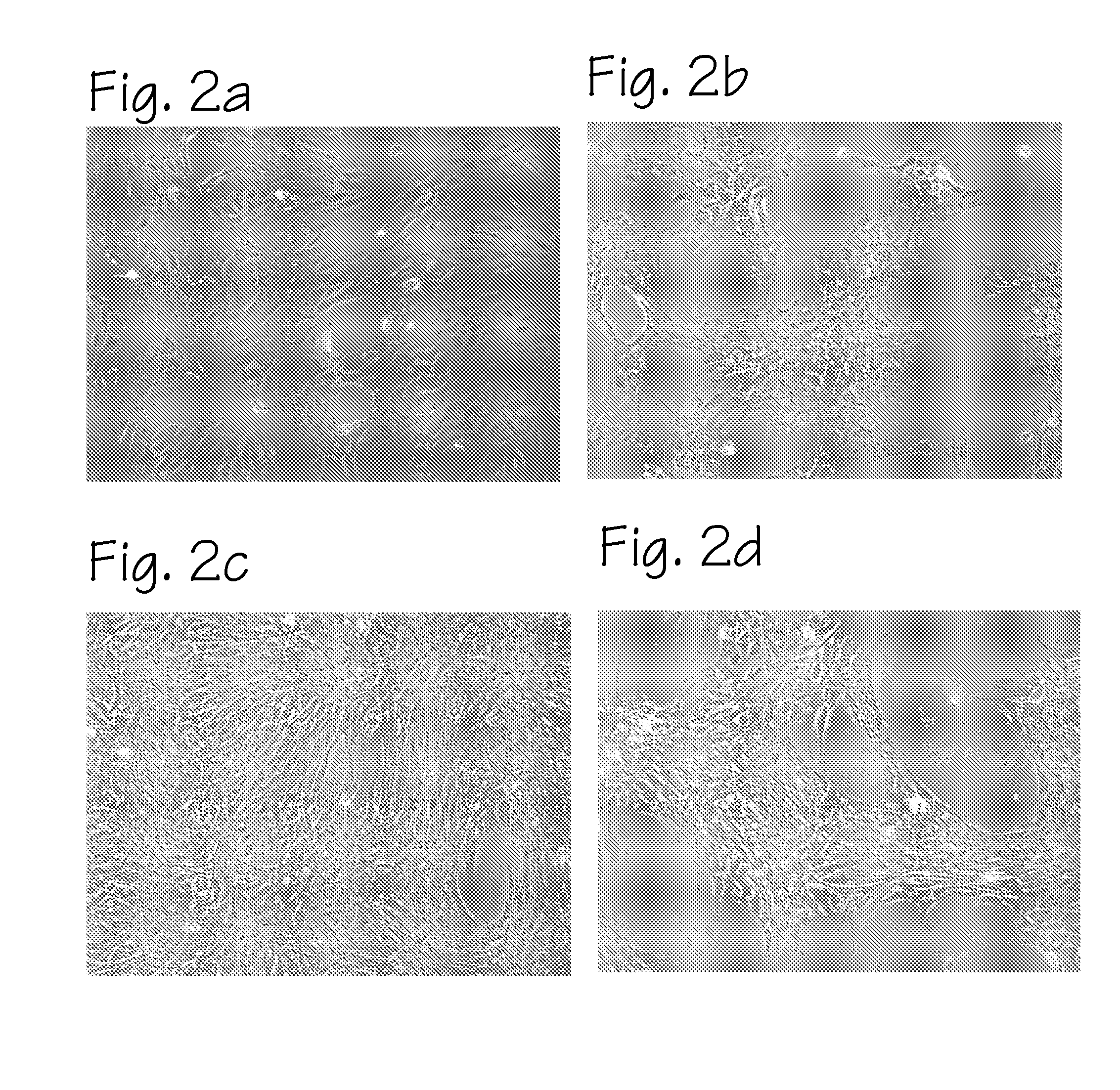 Method of preparing autologous cells and methods of use for therapy