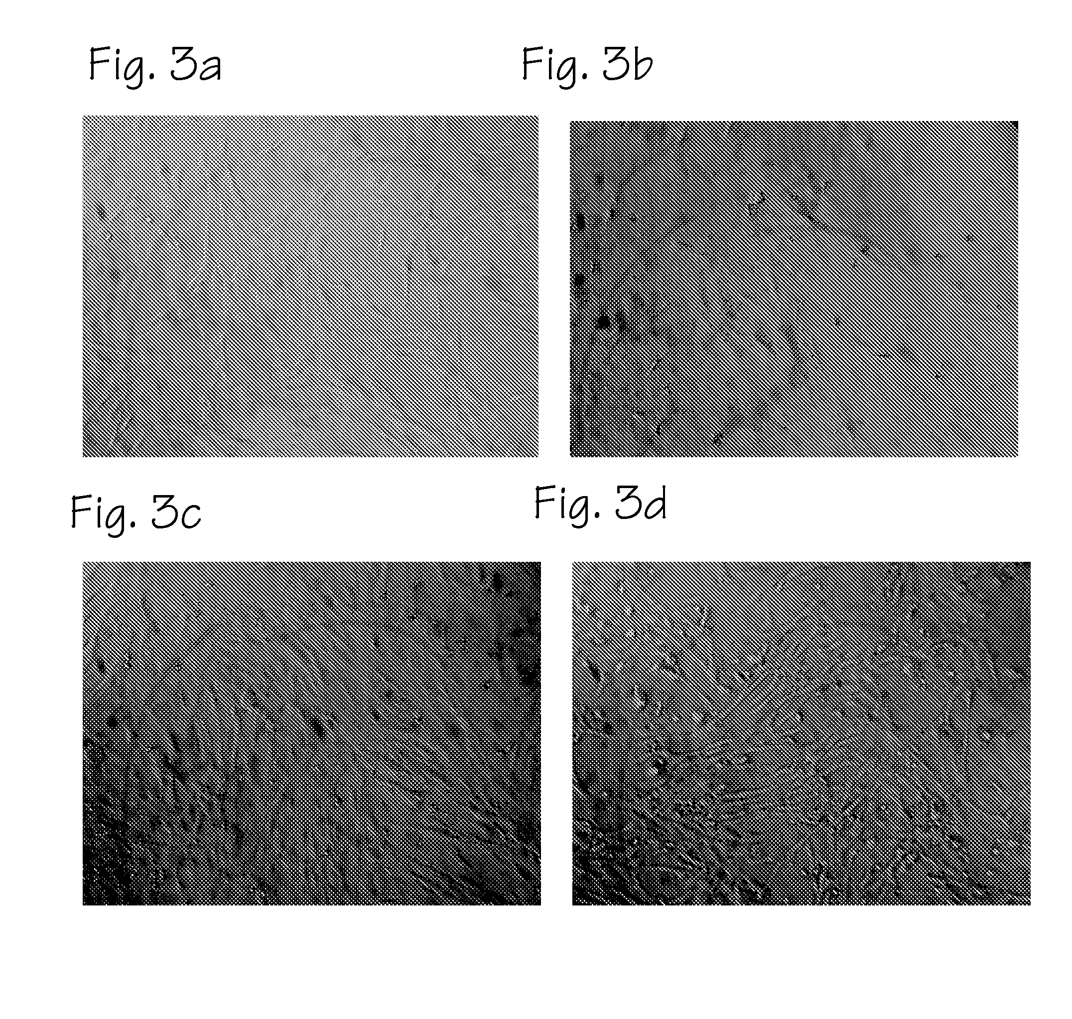 Method of preparing autologous cells and methods of use for therapy