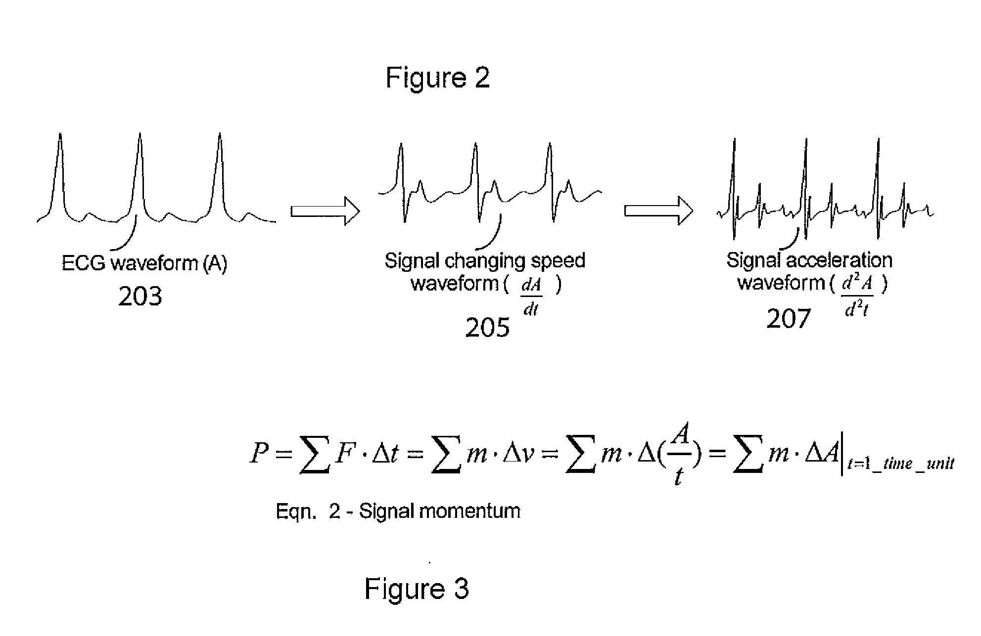 System for Heart Performance Characterization and Abnormality Detection