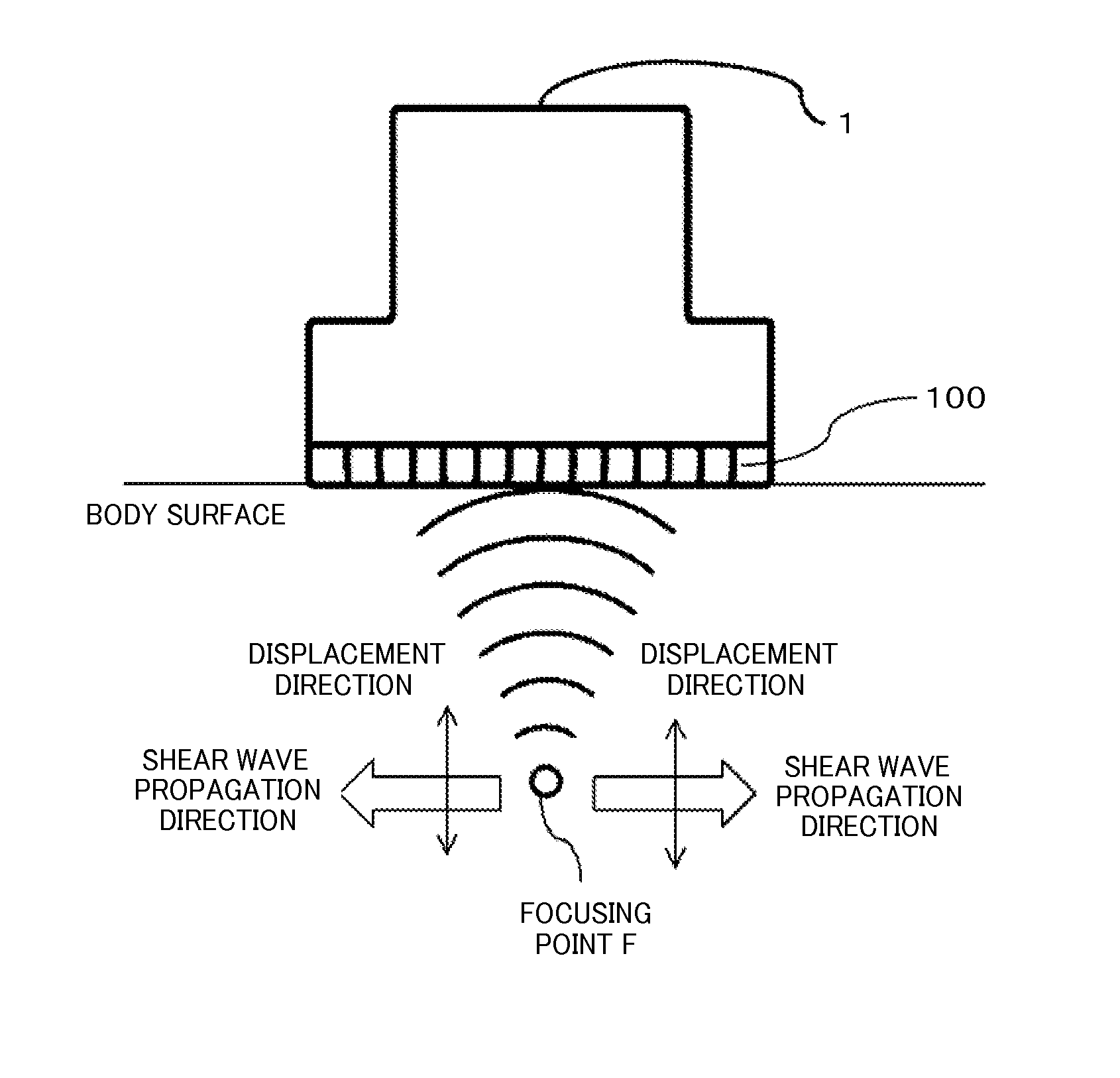 Apparatus and method for ultrasonic diagnosis