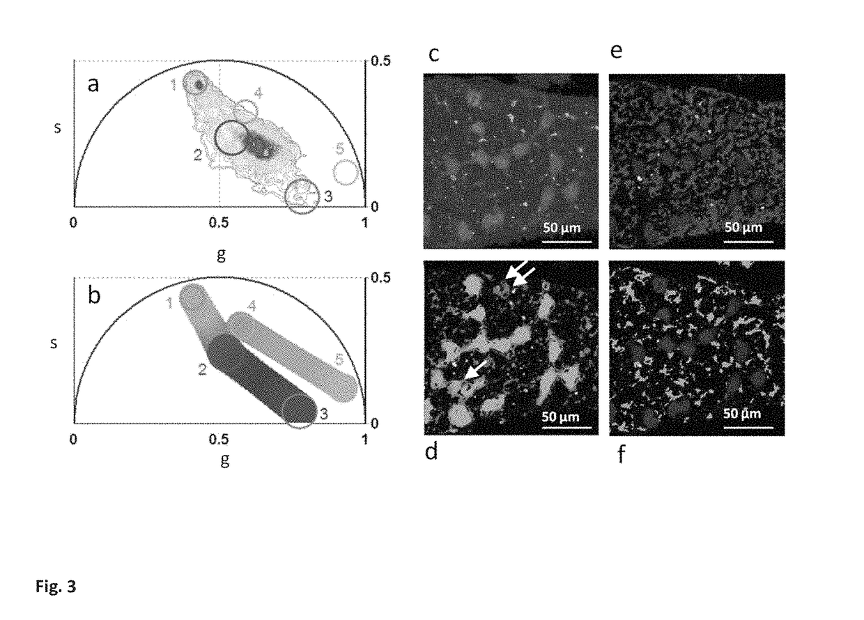 Phasor method to fluorescence lifetime microscopy to discriminate metabolic state of cells in living tissue