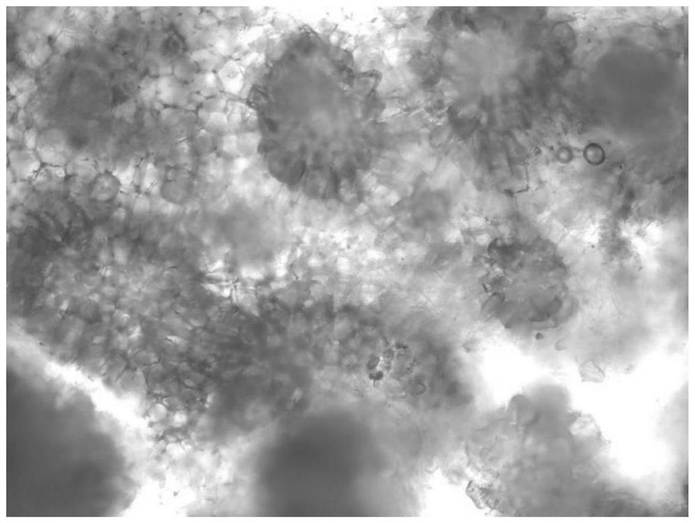 Pear fruit stone cell specific histochemical localization method