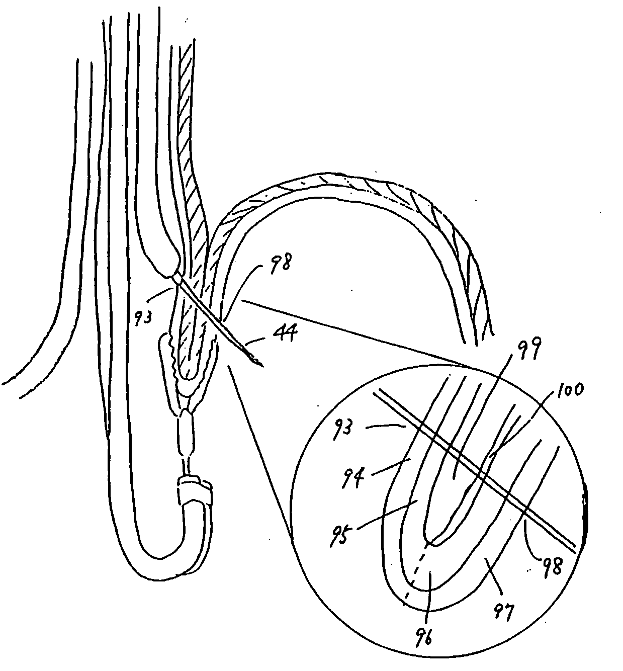 Endoscope and endoscopic instrument and method using same