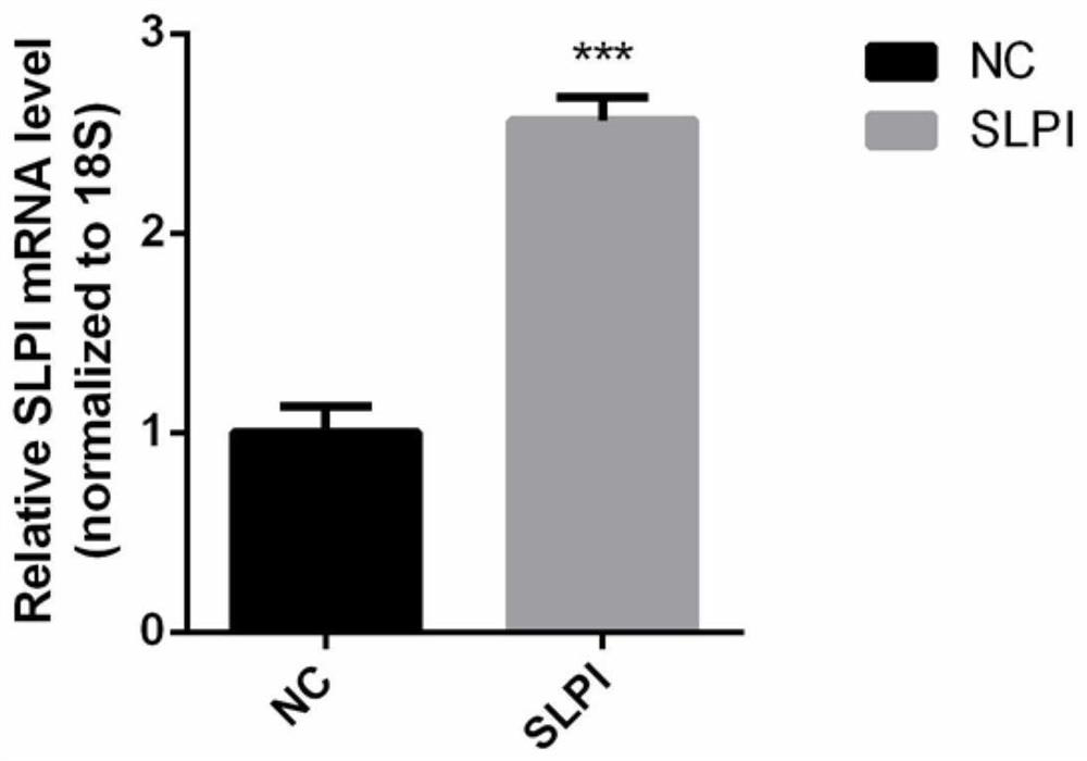 Use of secreted leukoproteinase inhibitor slpi as a prognostic marker for diabetic nephropathy dn