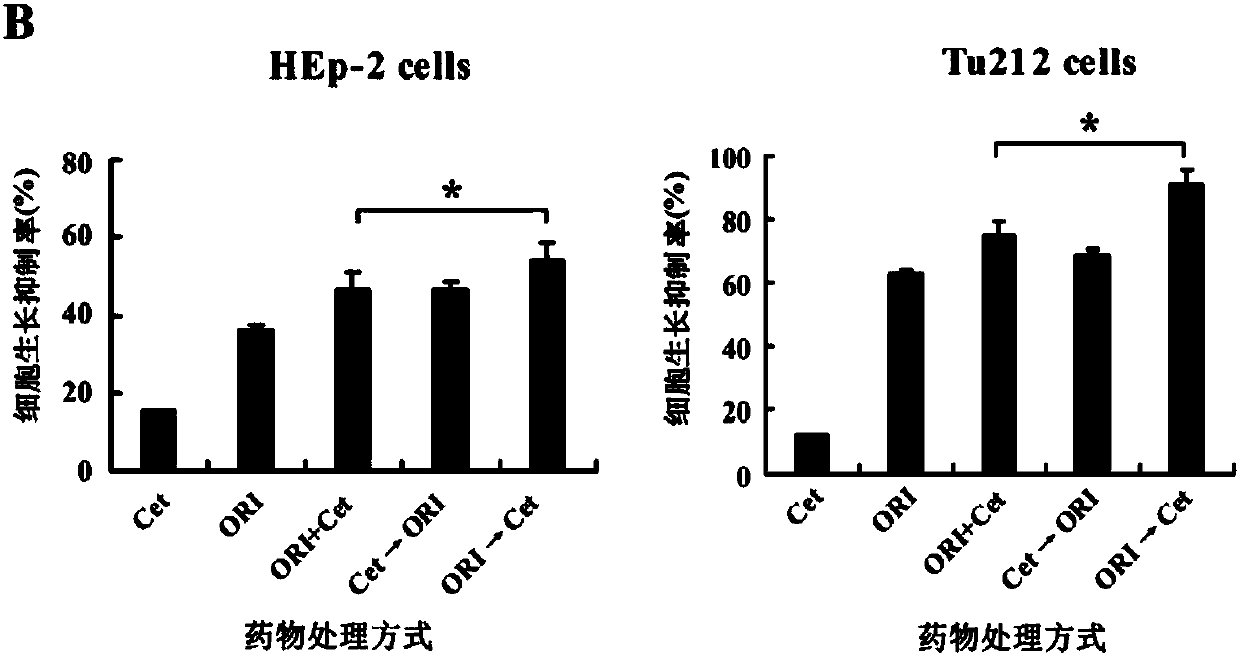 Antineoplastic pharmaceutical composition and application thereof