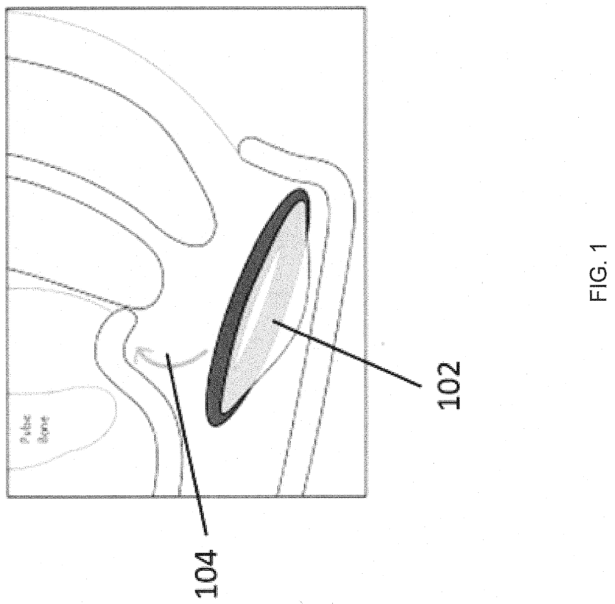 Applicator for a menstrual device