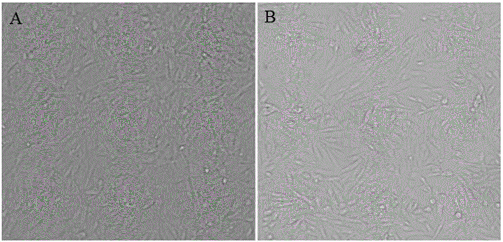 Method for constructing spleen tissue cell line of acipenser dabryanus