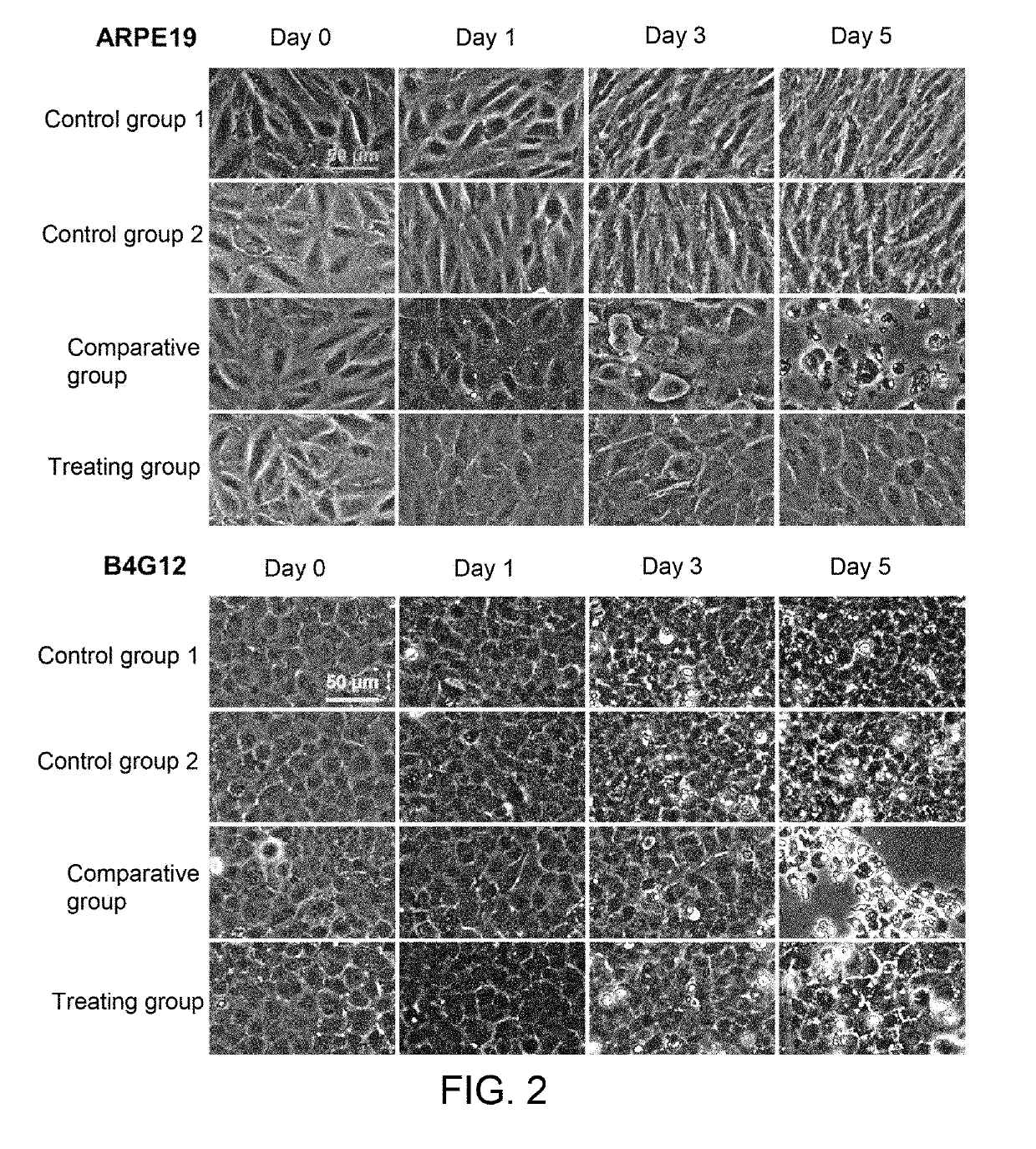 Method for protecting corneal endothelial cells from the impact caused by an eye surgery