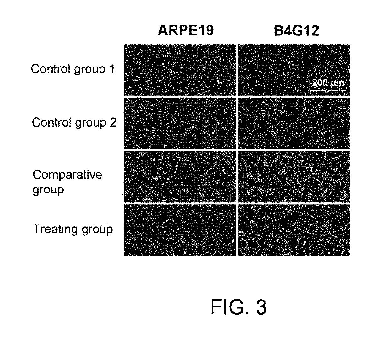 Method for protecting corneal endothelial cells from the impact caused by an eye surgery