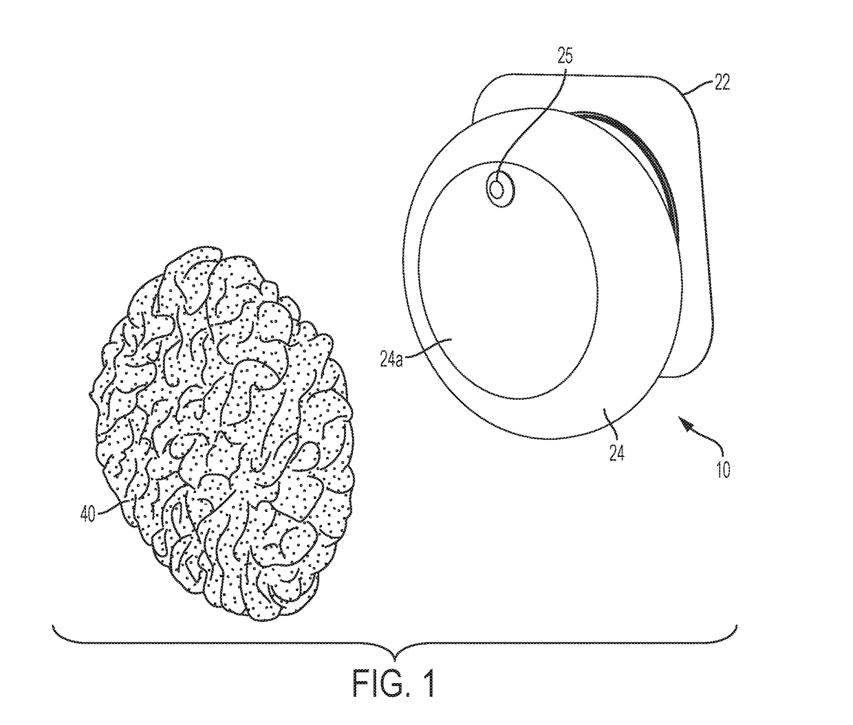 Ostomy appliance