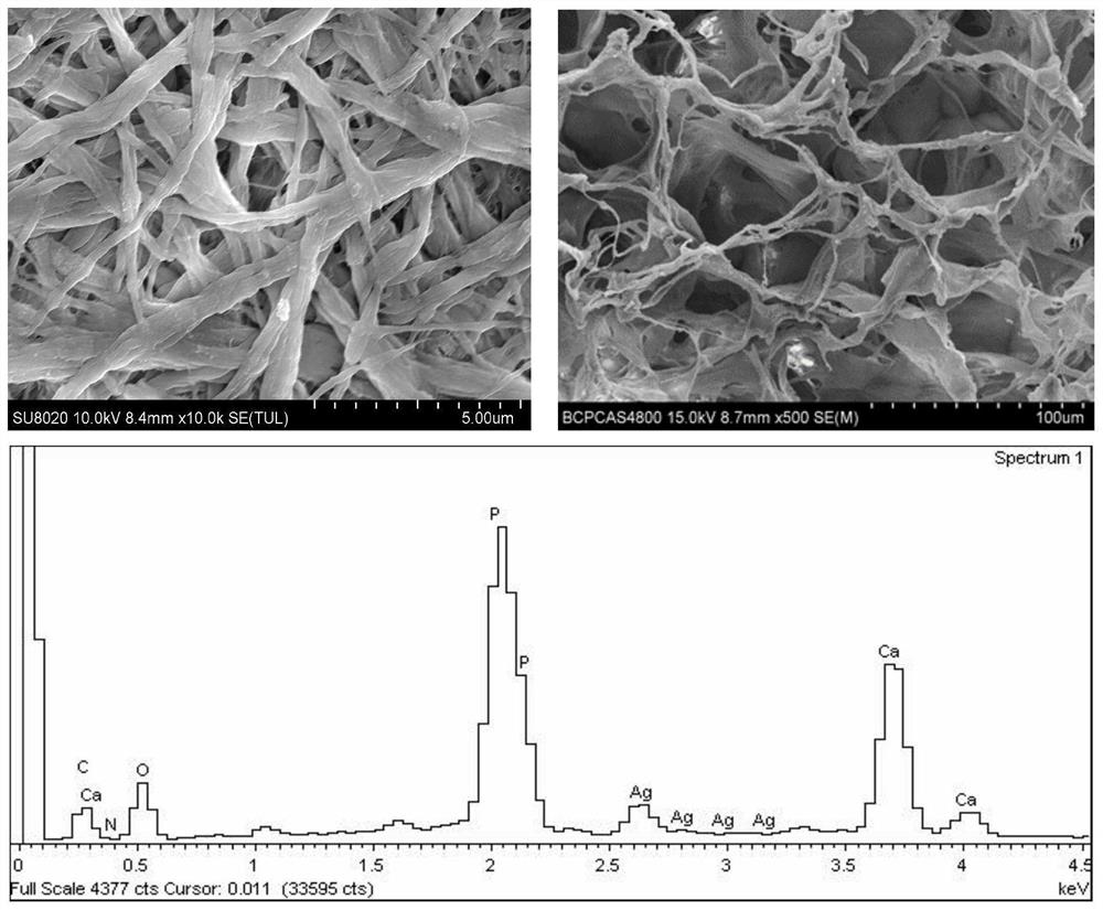 Silver nanowire-mineralized collagen co-assembled biomimetic scaffold and its preparation method and application