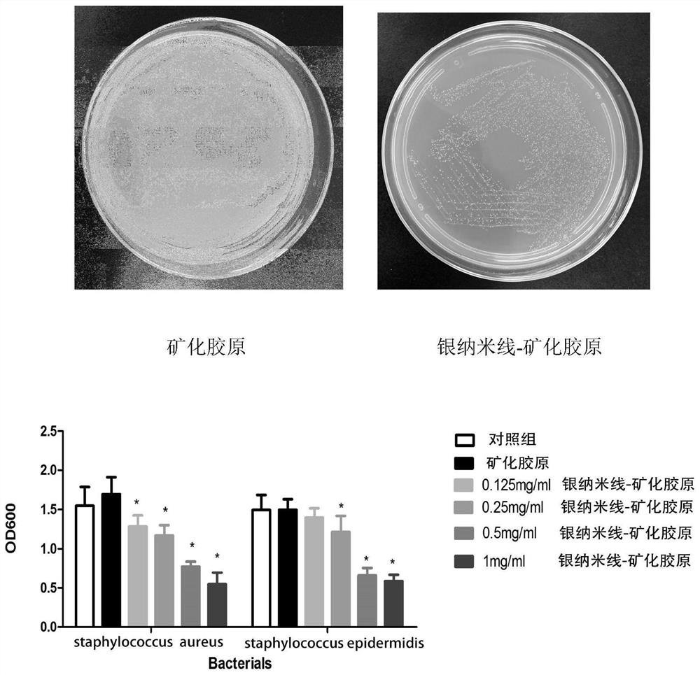 Silver nanowire-mineralized collagen co-assembled biomimetic scaffold and its preparation method and application