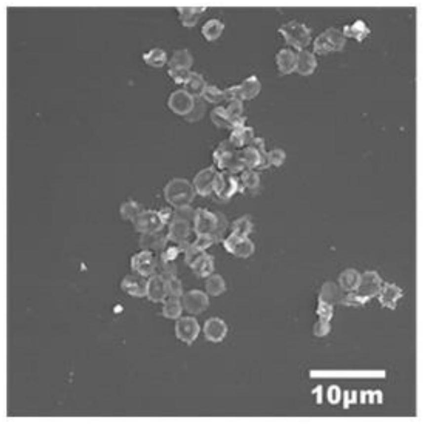 Polymer-entrapped erythrocyte membrane composite material as well as preparation method and application thereof