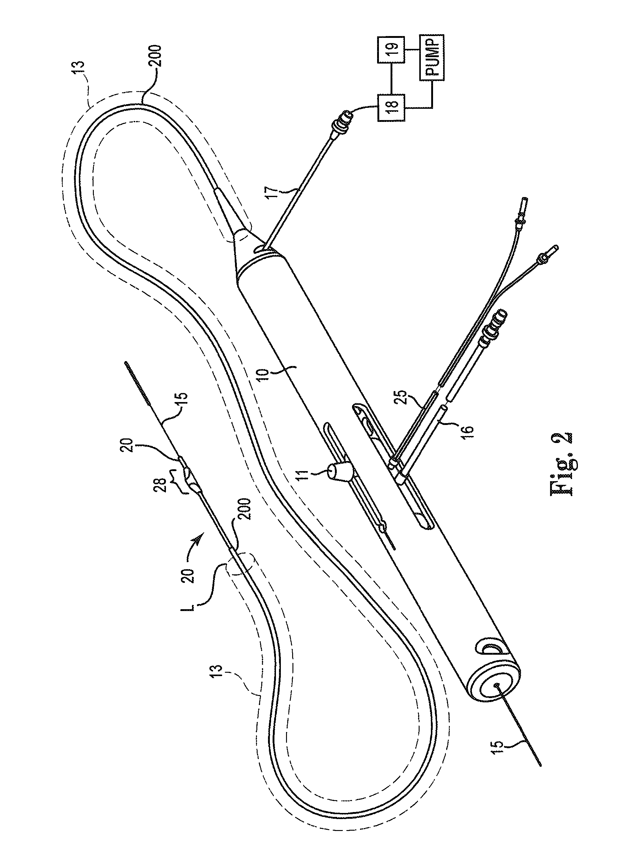 High-speed rotational atherectomy system, device and method for localized application of therapeutic agents to a biological conduit