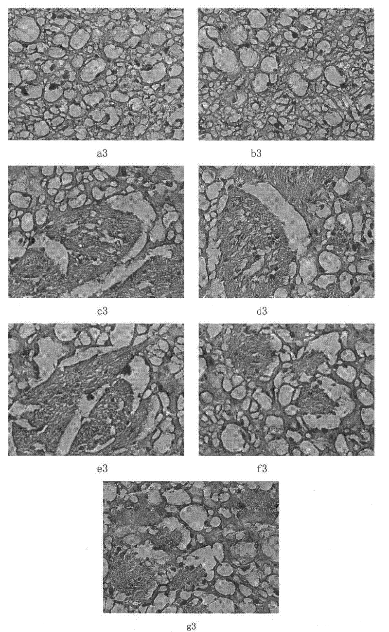 Medicament for treating senile dementia and preparation method thereof