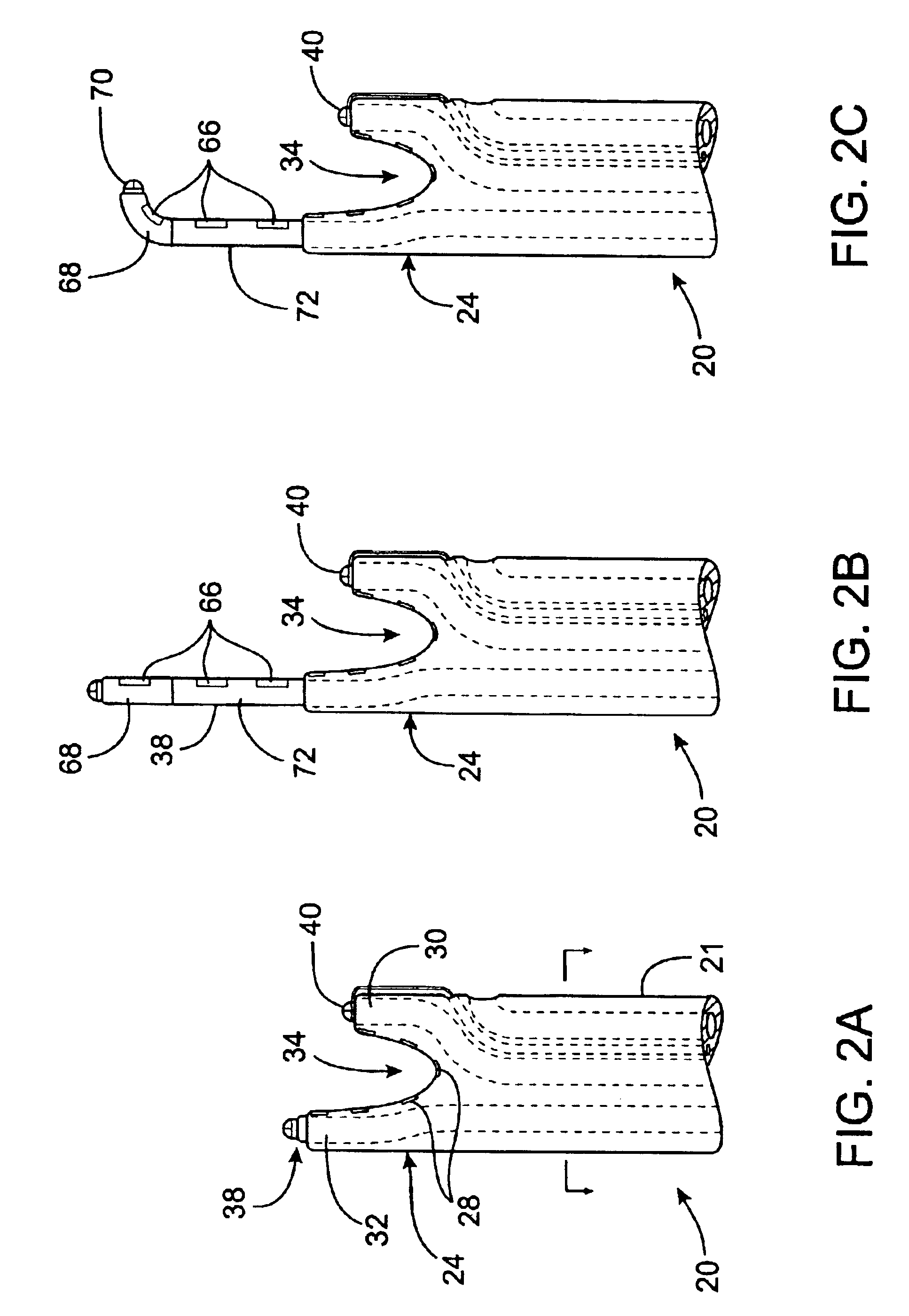 Apparatus and method for diagnosis and therapy of electrophysiological disease