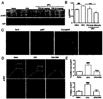 Method of using triptonide for alleviating mouse hyperalgesia reaction induced by CFA