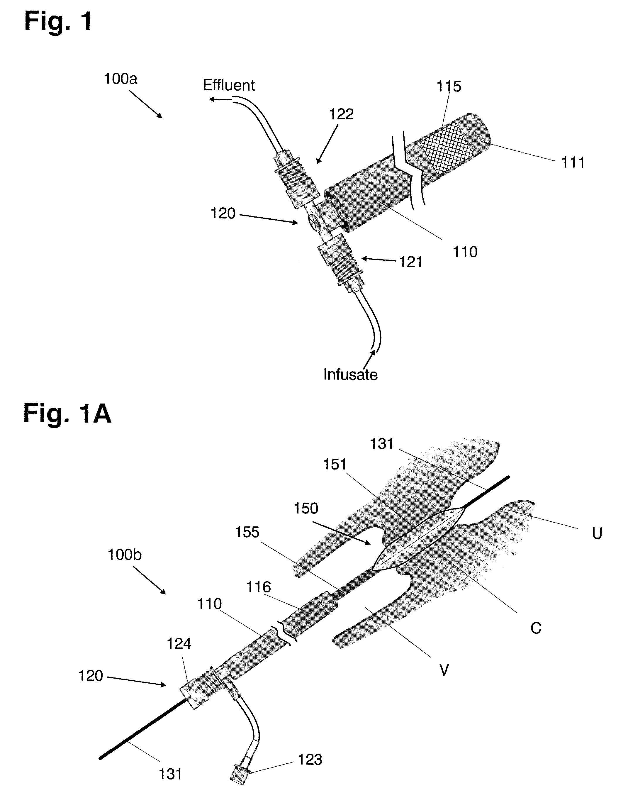 Systems and methods for preventing intravasation during intrauterine procedures