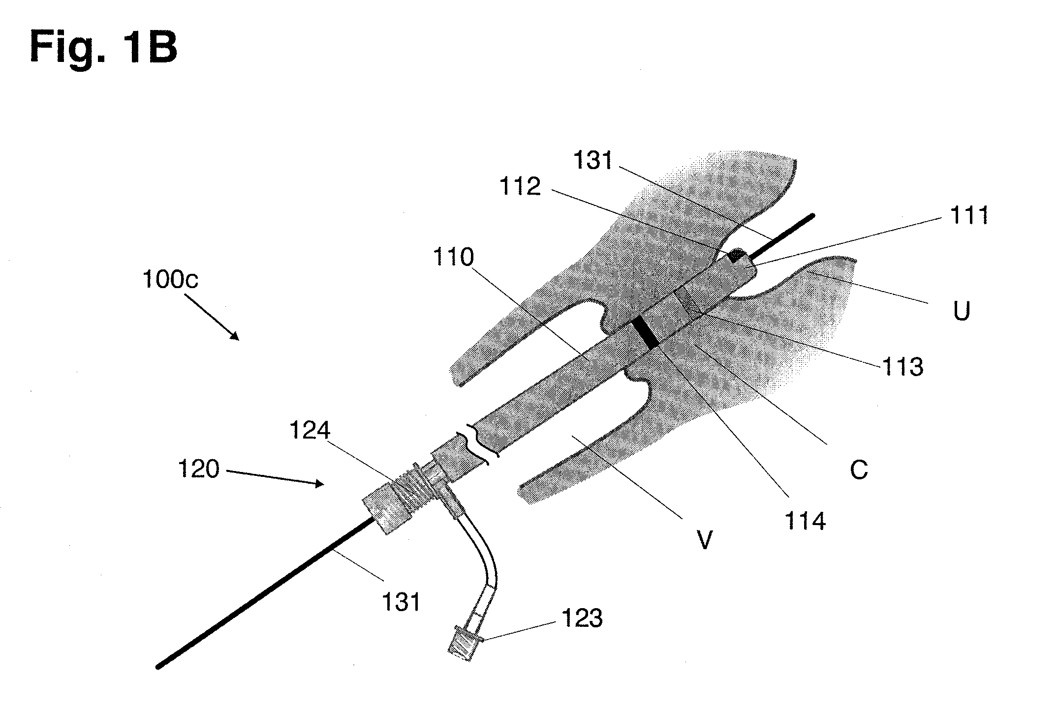 Systems and methods for preventing intravasation during intrauterine procedures