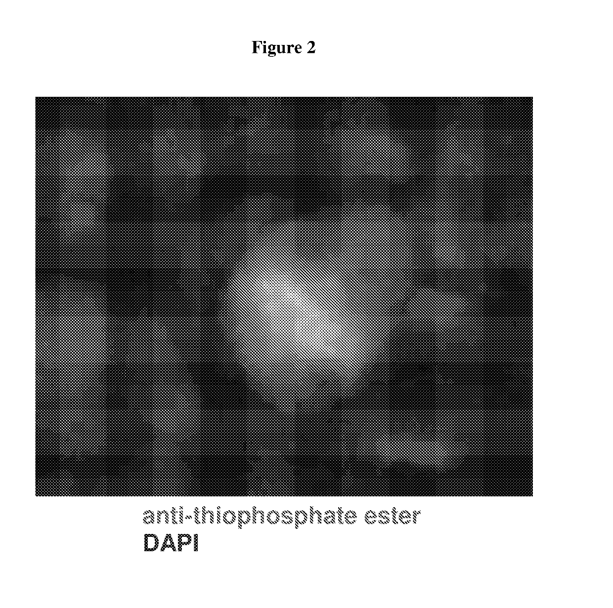 In situ visualization of kinase activity